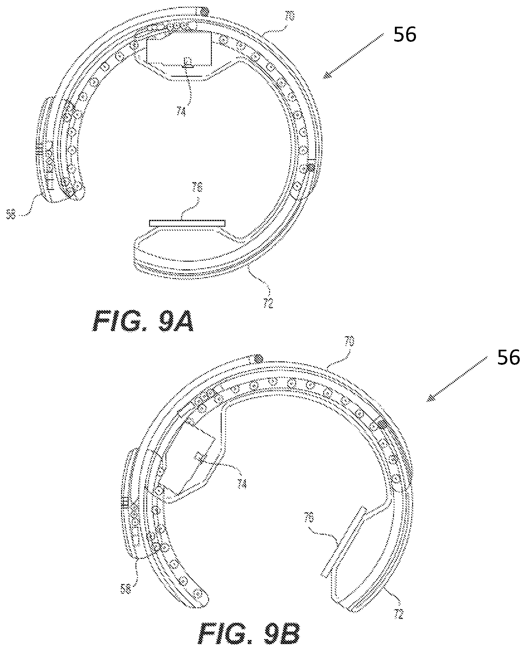 Patent US12396692 Figure 9 – Compound curve cable chain