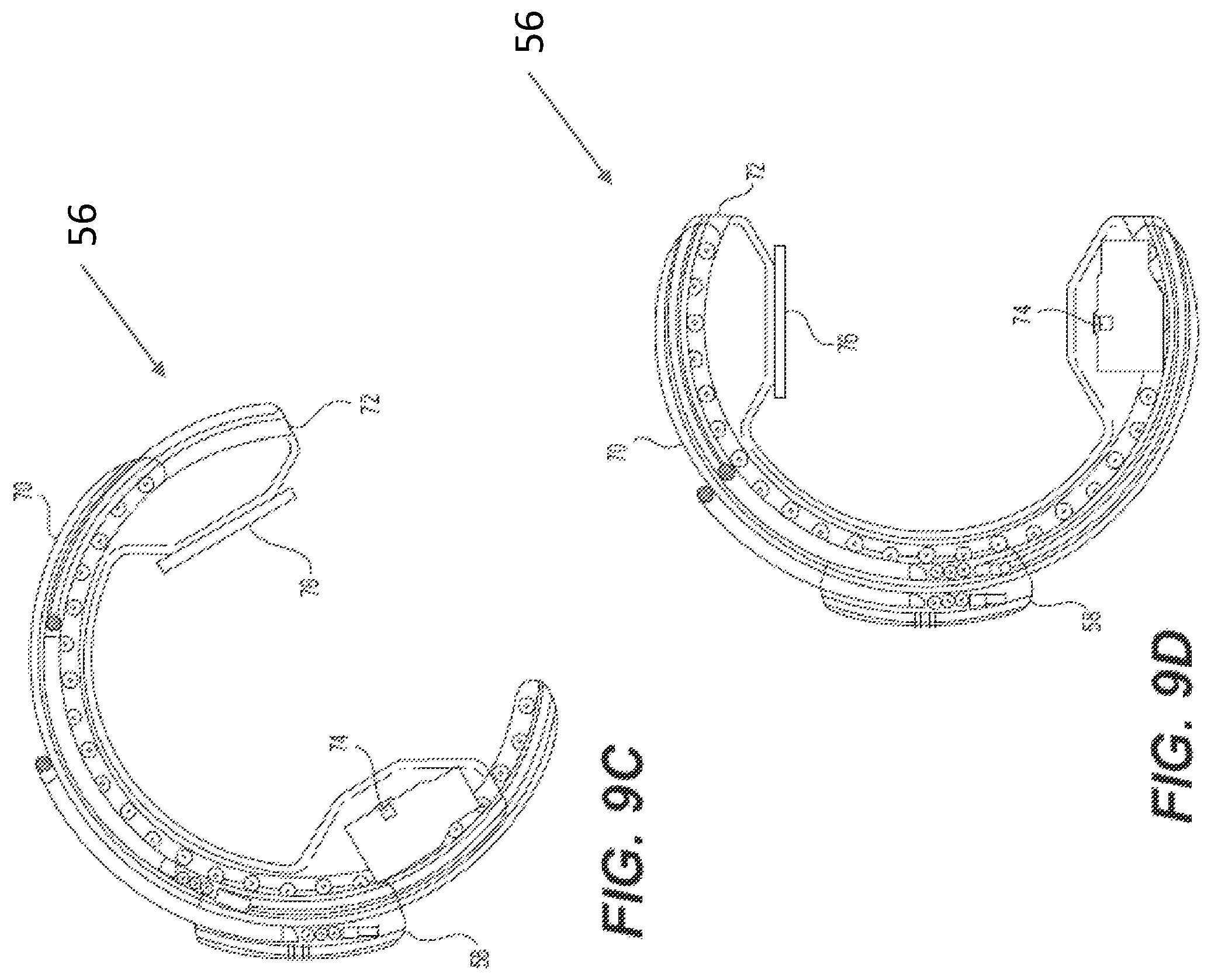 Patent US12396692 Figure 10 – Compound curve cable chain