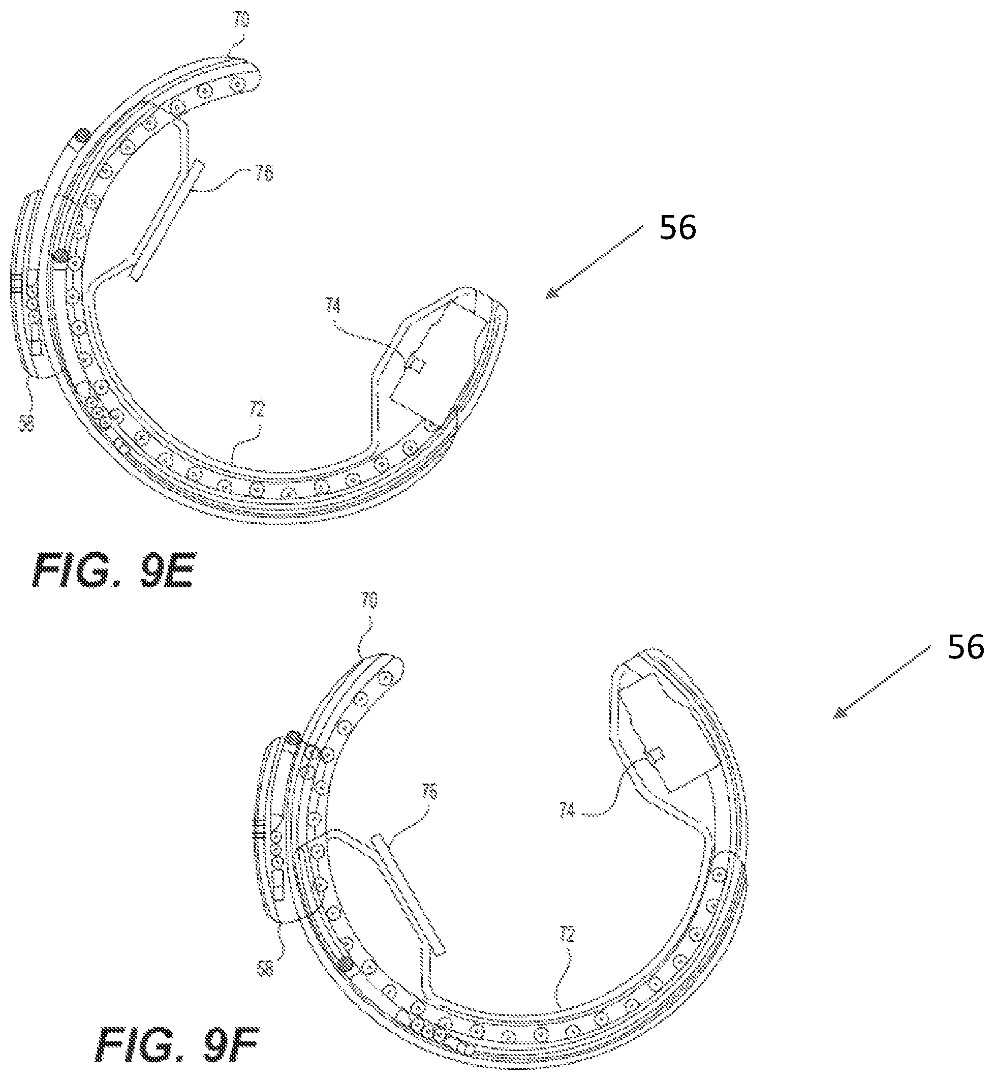 Patent US12396692 Figure 11 – Compound curve cable chain