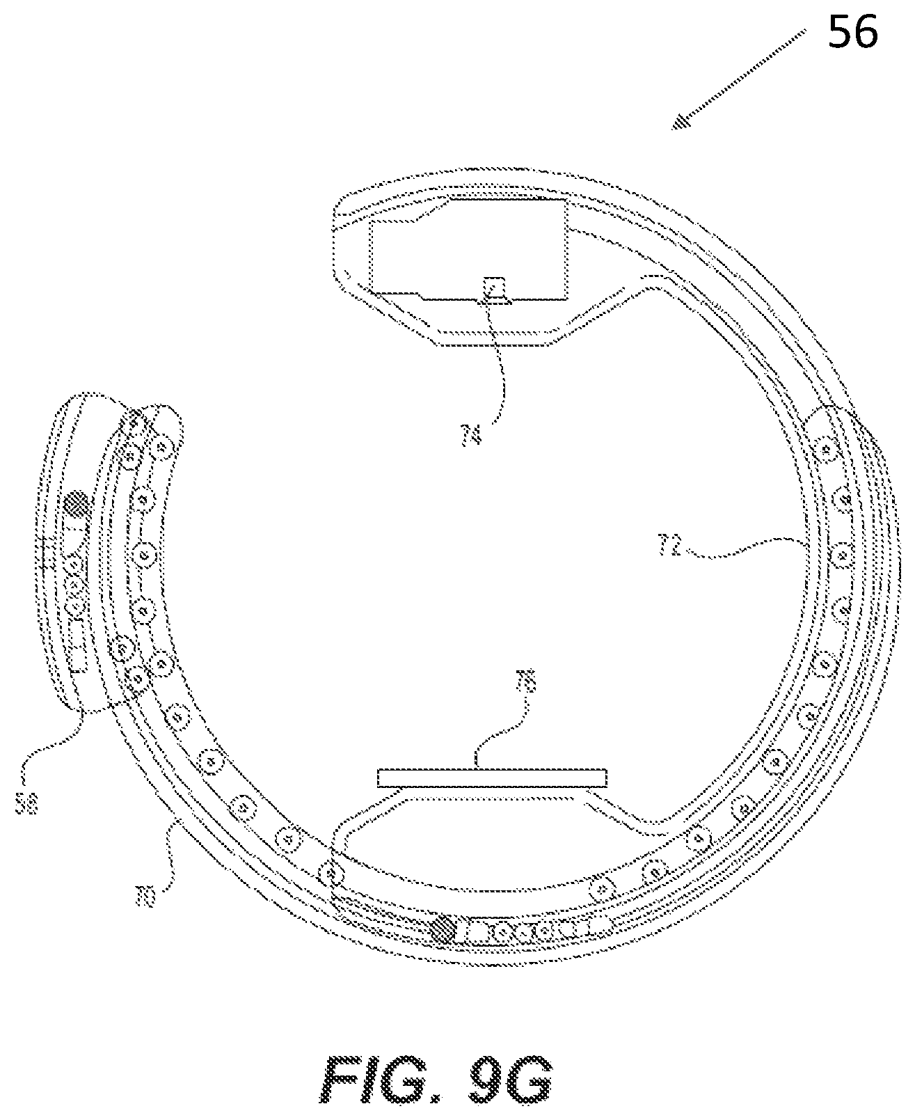 Patent US12396692 Figure 12 – Compound curve cable chain