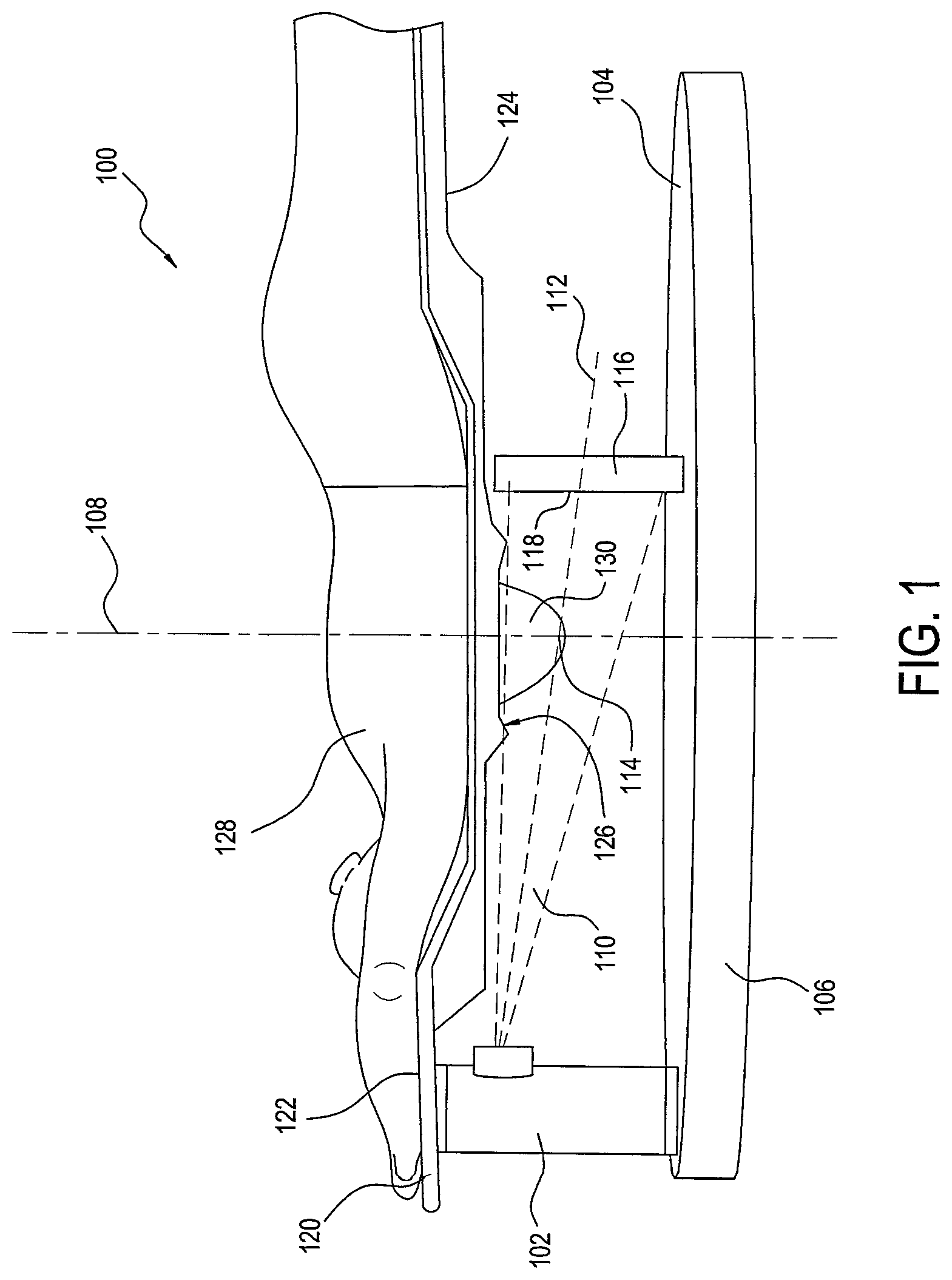 Patent US12396694 — Stationary detail imaging in cone beam breast computed tomography — Figure 1