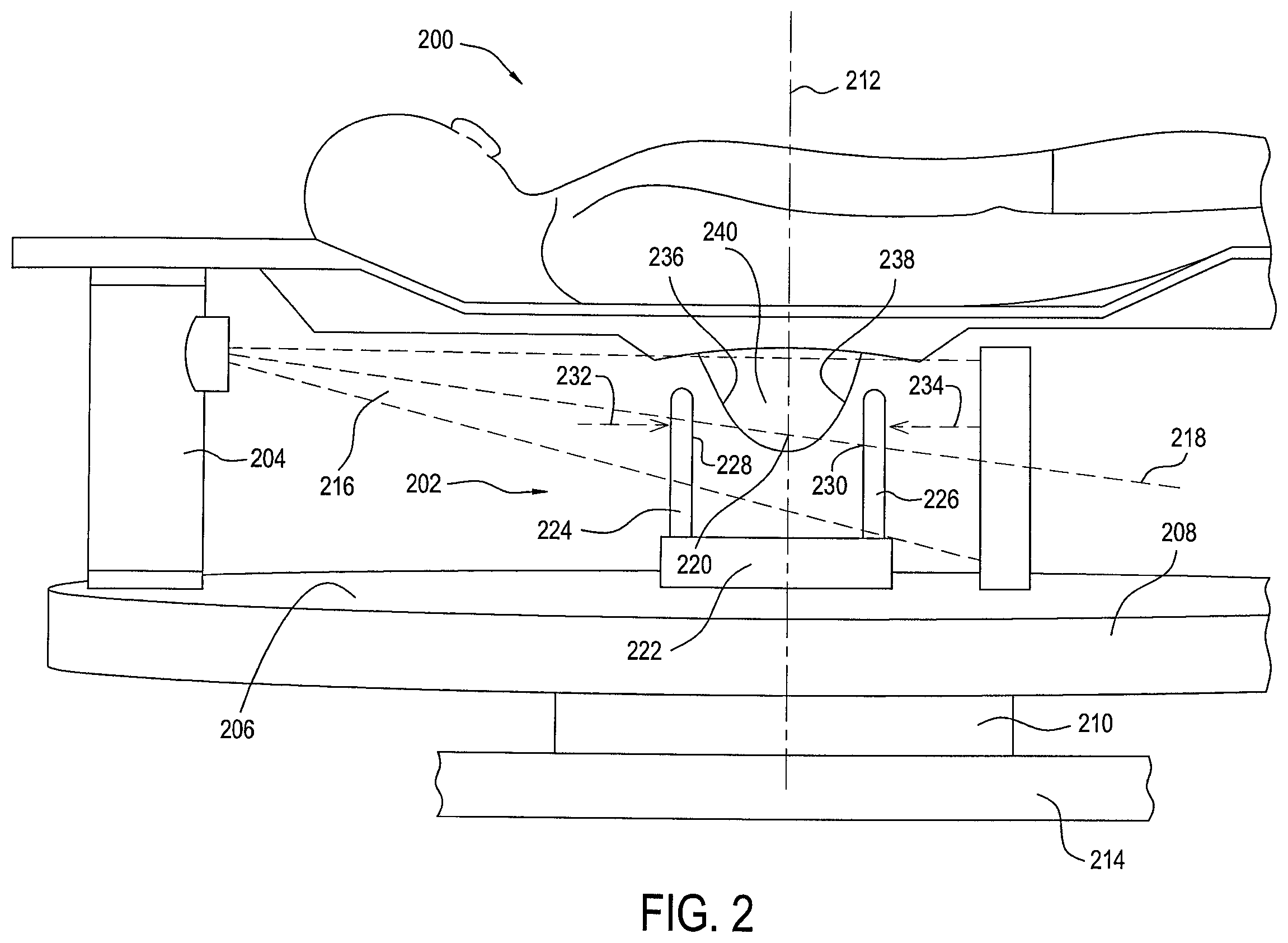 Patent US12396694 Figure 2 – Stationary detail imaging in cone beam breast computed tomography