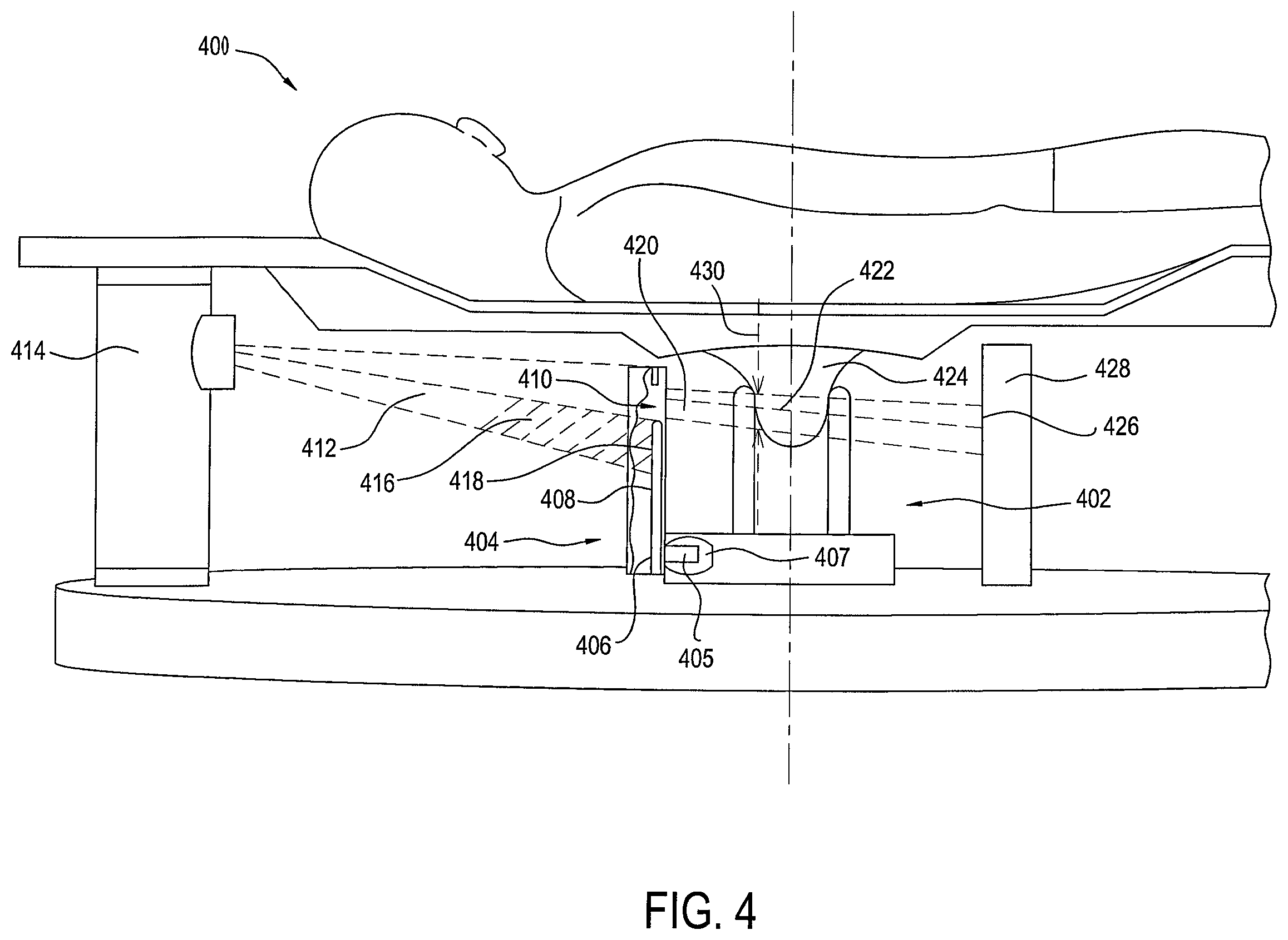 Patent US12396694 Figure 4 – Stationary detail imaging in cone beam breast computed tomography
