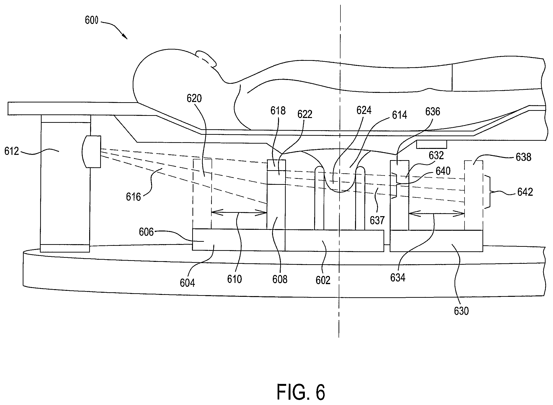 Patent US12396694 Figure 6 – Stationary detail imaging in cone beam breast computed tomography