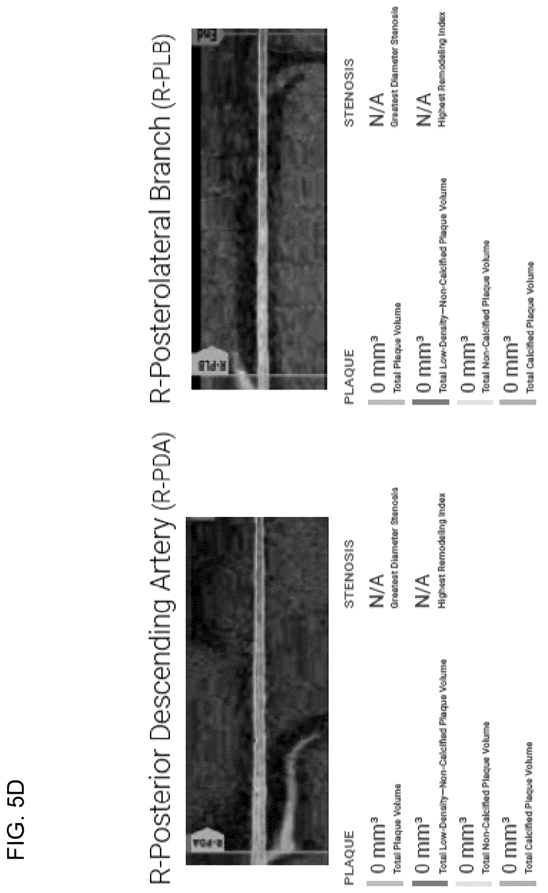 Patent US12396695 Figure 14 – Systems, methods, and devices for medical image analysis, diagnosis, risk stratification, decision making and/or disease tracking