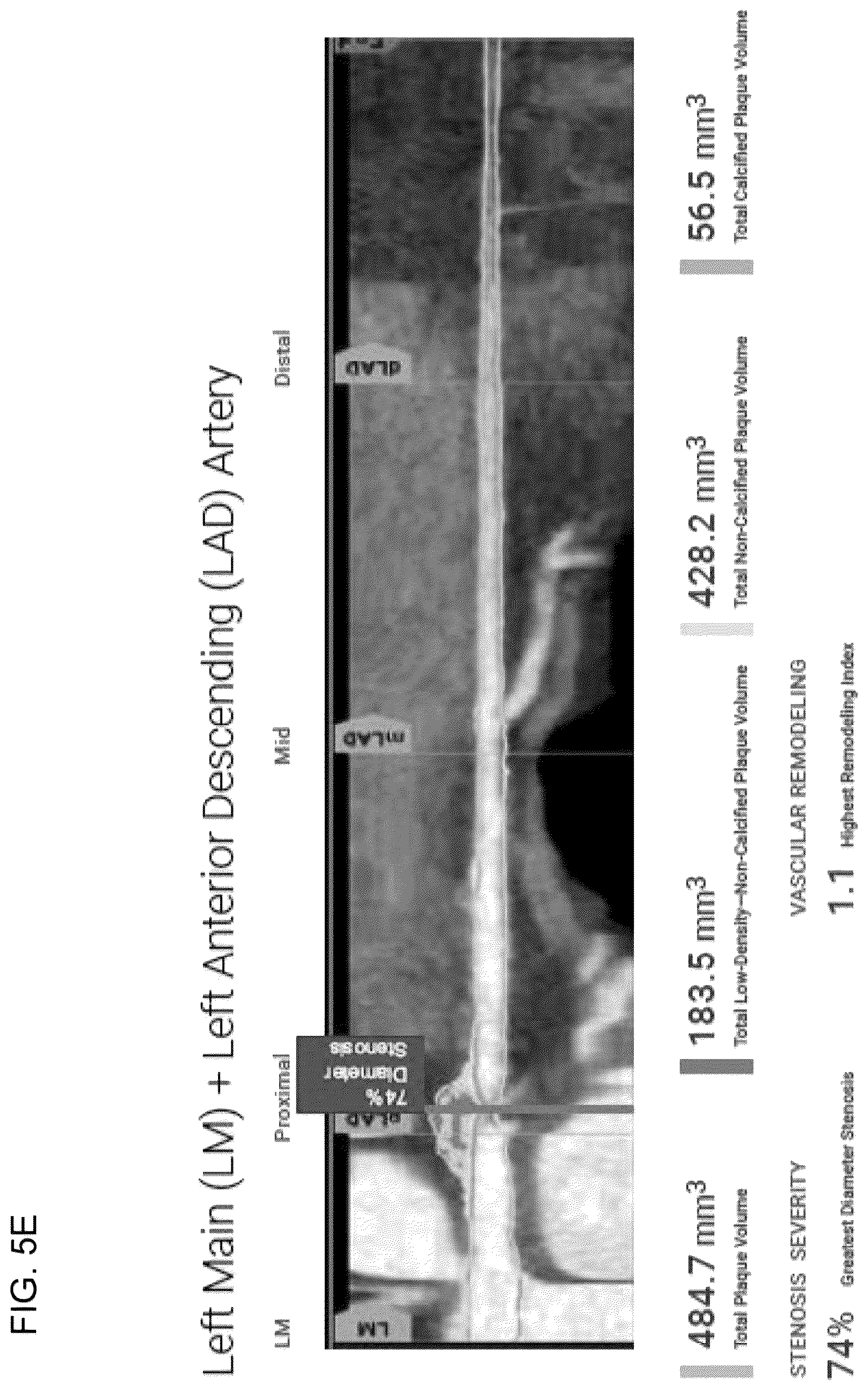 Patent US12396695 Figure 15 – Systems, methods, and devices for medical image analysis, diagnosis, risk stratification, decision making and/or disease tracking