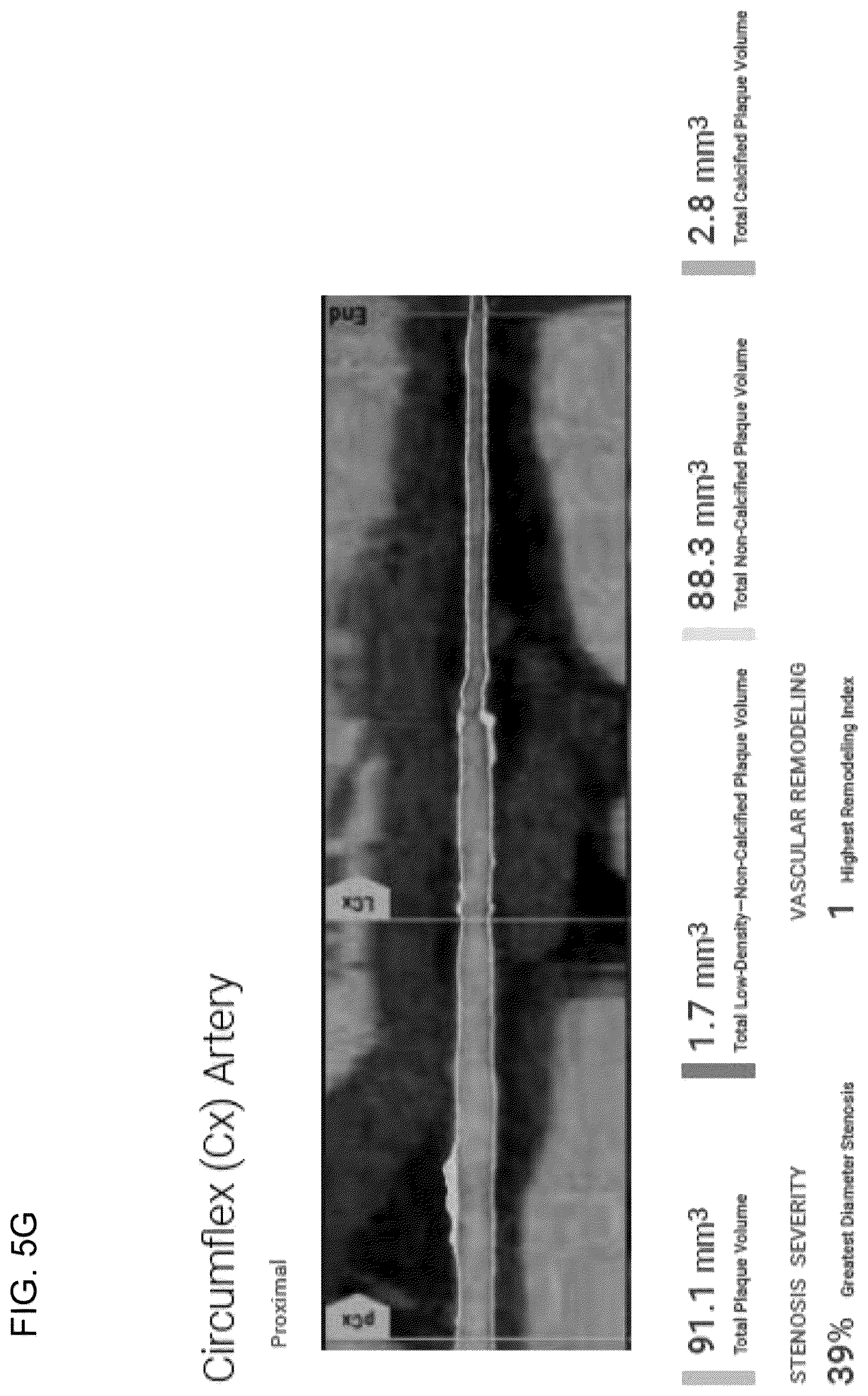 Patent US12396695 Figure 17 – Systems, methods, and devices for medical image analysis, diagnosis, risk stratification, decision making and/or disease tracking