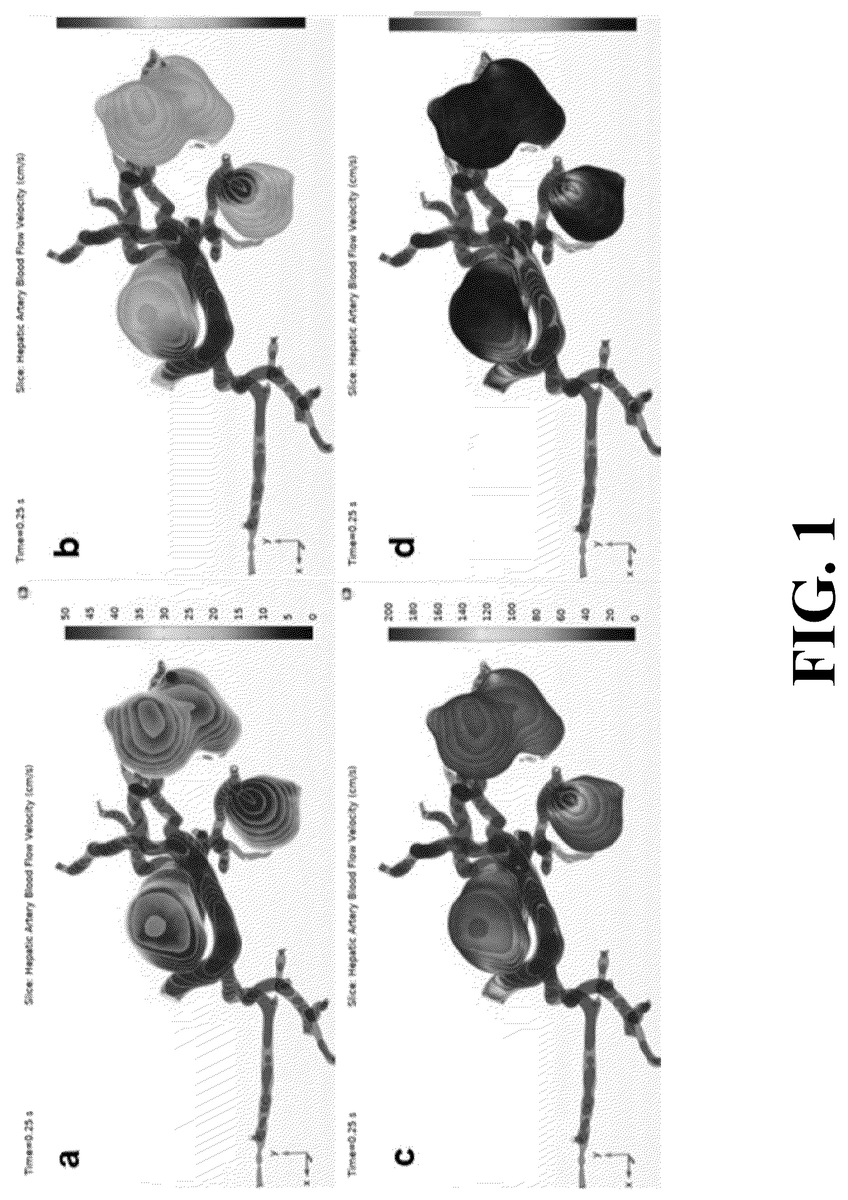 Patent US12396696 — Physiological modeling of multiphase intra-arterial CT angiography for hepatic embolization therapy — Figure 1