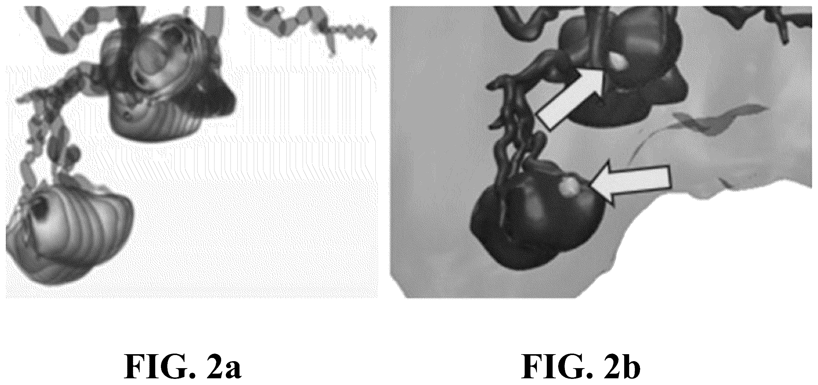 Patent US12396696 Figure 2 – Physiological modeling of multiphase intra-arterial CT angiography for hepatic embolization therapy