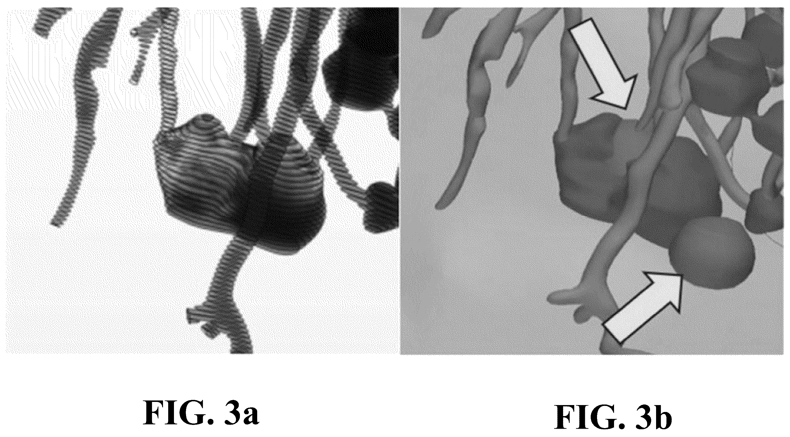 Patent US12396696 Figure 3 – Physiological modeling of multiphase intra-arterial CT angiography for hepatic embolization therapy