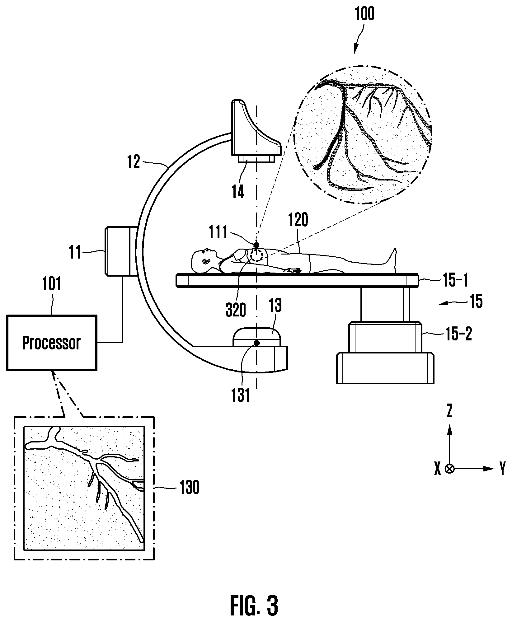 Patent US12396697 Figure 3 – Blood vessel image calibration method and device