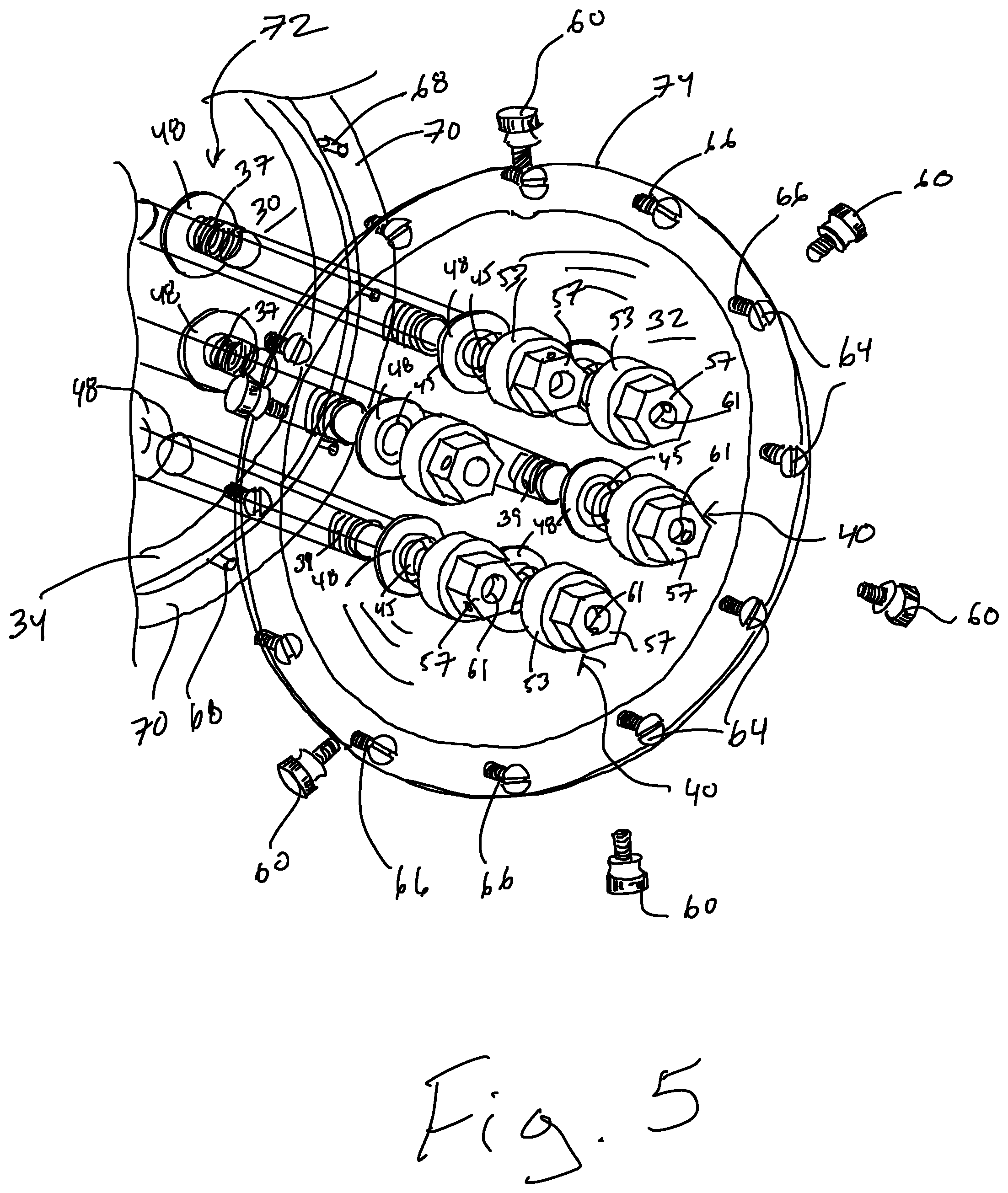 Patent US12396700 Figure 4 – Flexible modular phantom and method for medical applications using interchangeable inserts