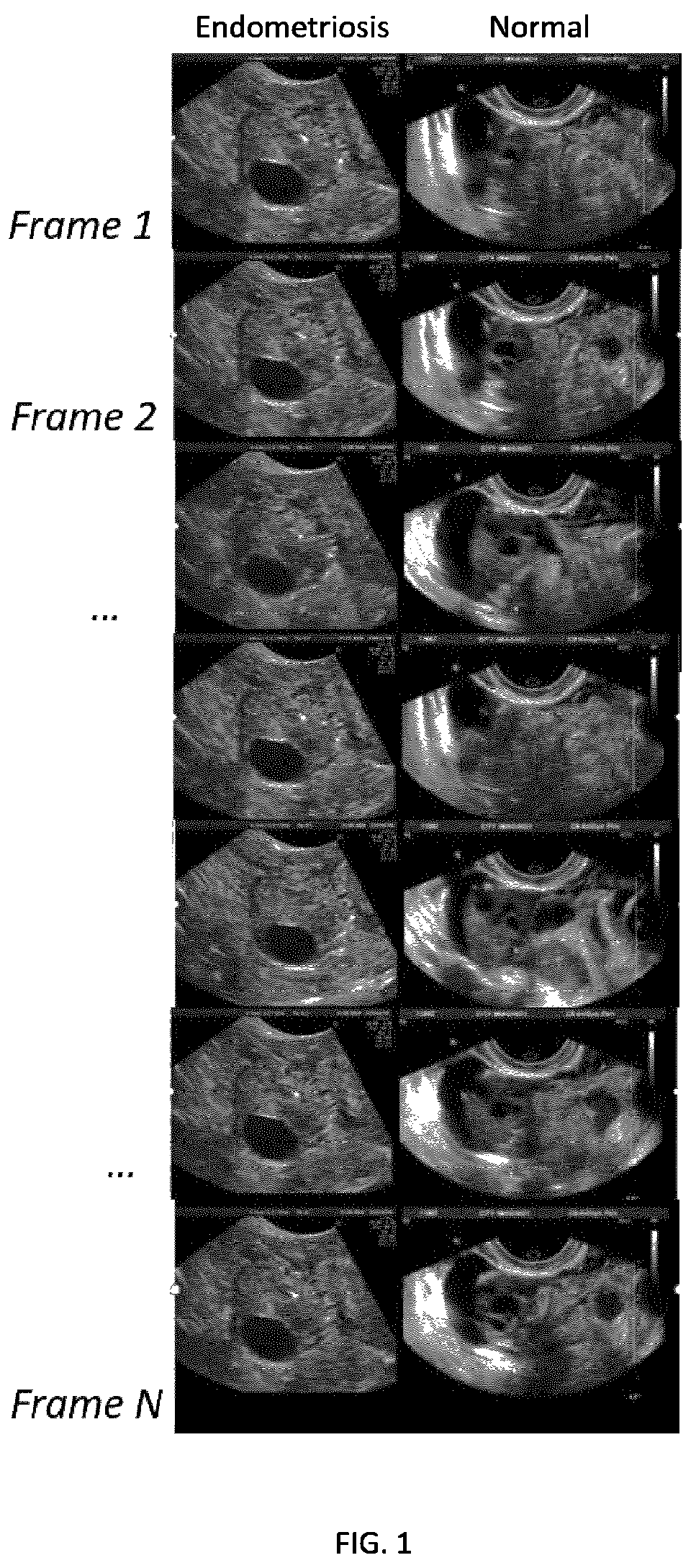 Patent US12396702 Figure 1 – Systems, methods, and apparatuses for quantitative assessment of organ mobility