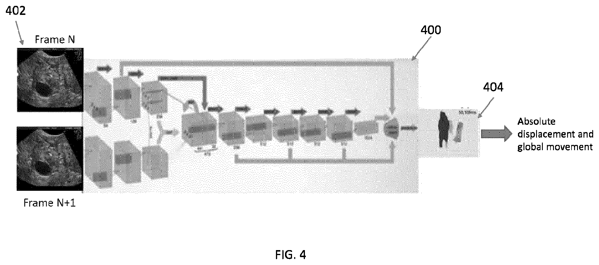 Patent US12396702 Figure 4 – Systems, methods, and apparatuses for quantitative assessment of organ mobility