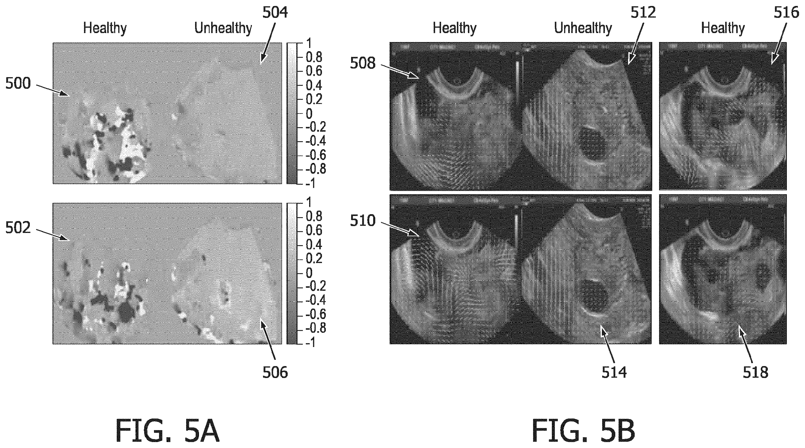 Patent US12396702 Figure 5 – Systems, methods, and apparatuses for quantitative assessment of organ mobility