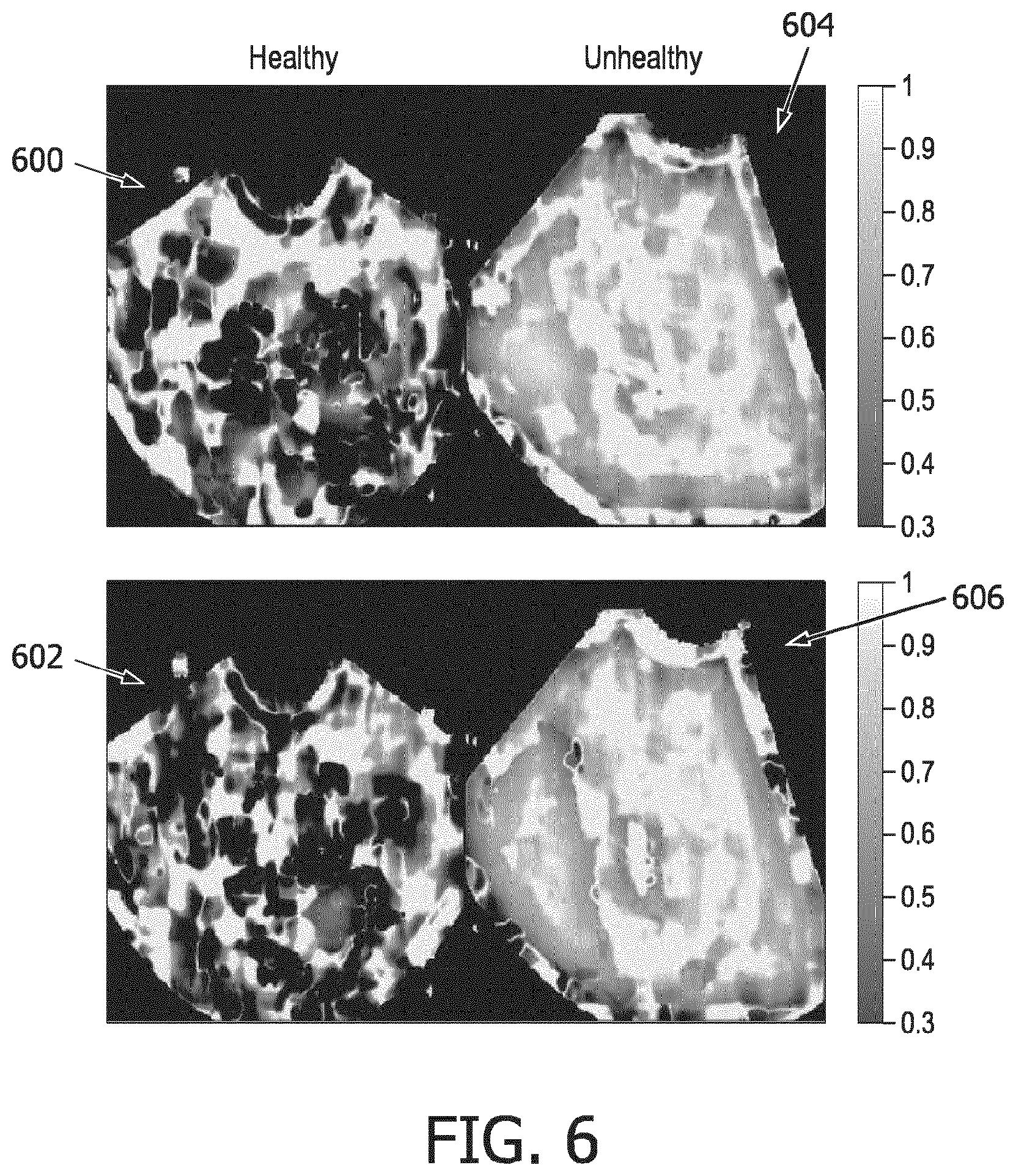 Patent US12396702 Figure 6 – Systems, methods, and apparatuses for quantitative assessment of organ mobility