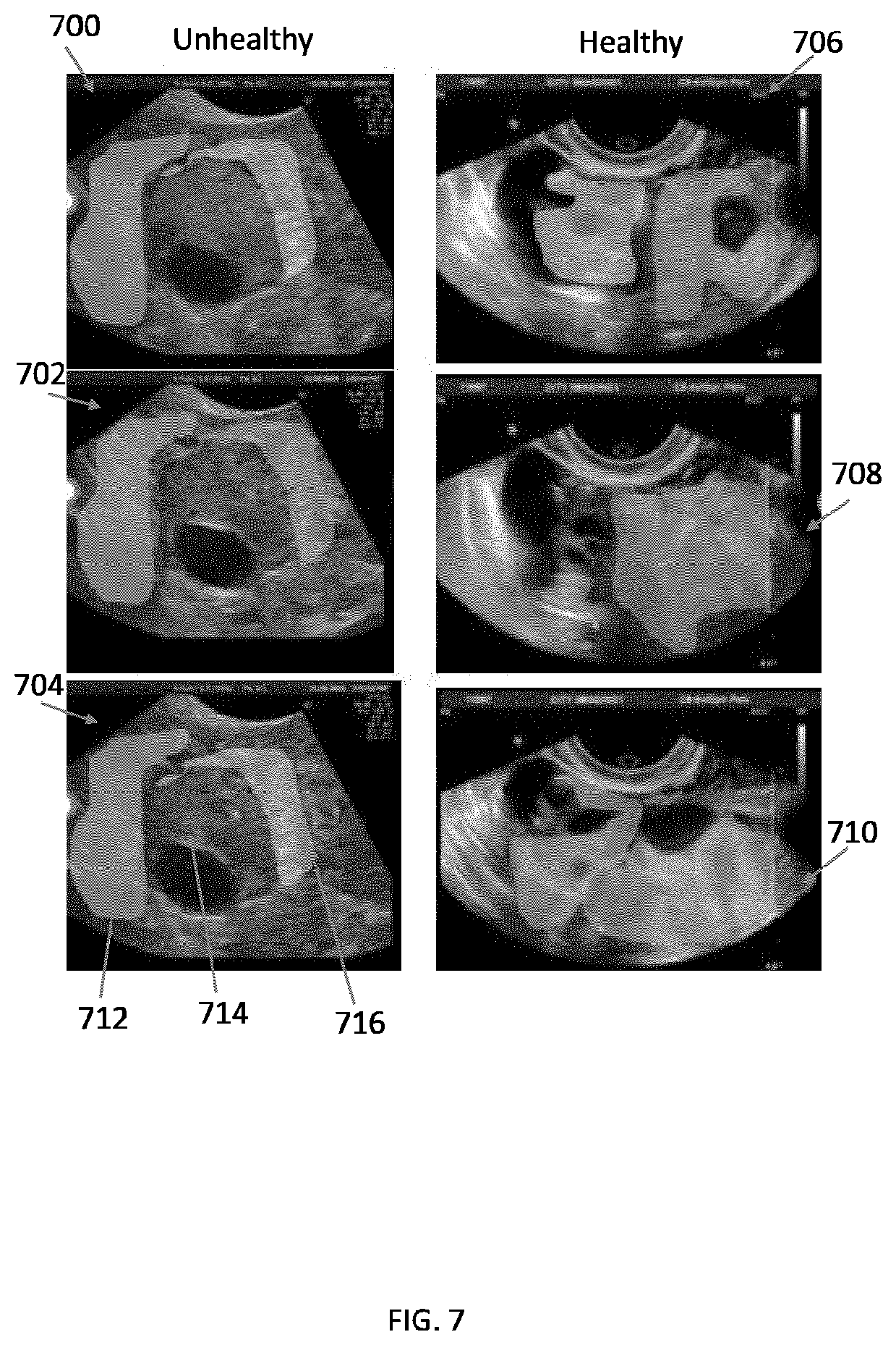 Patent US12396702 Figure 7 – Systems, methods, and apparatuses for quantitative assessment of organ mobility