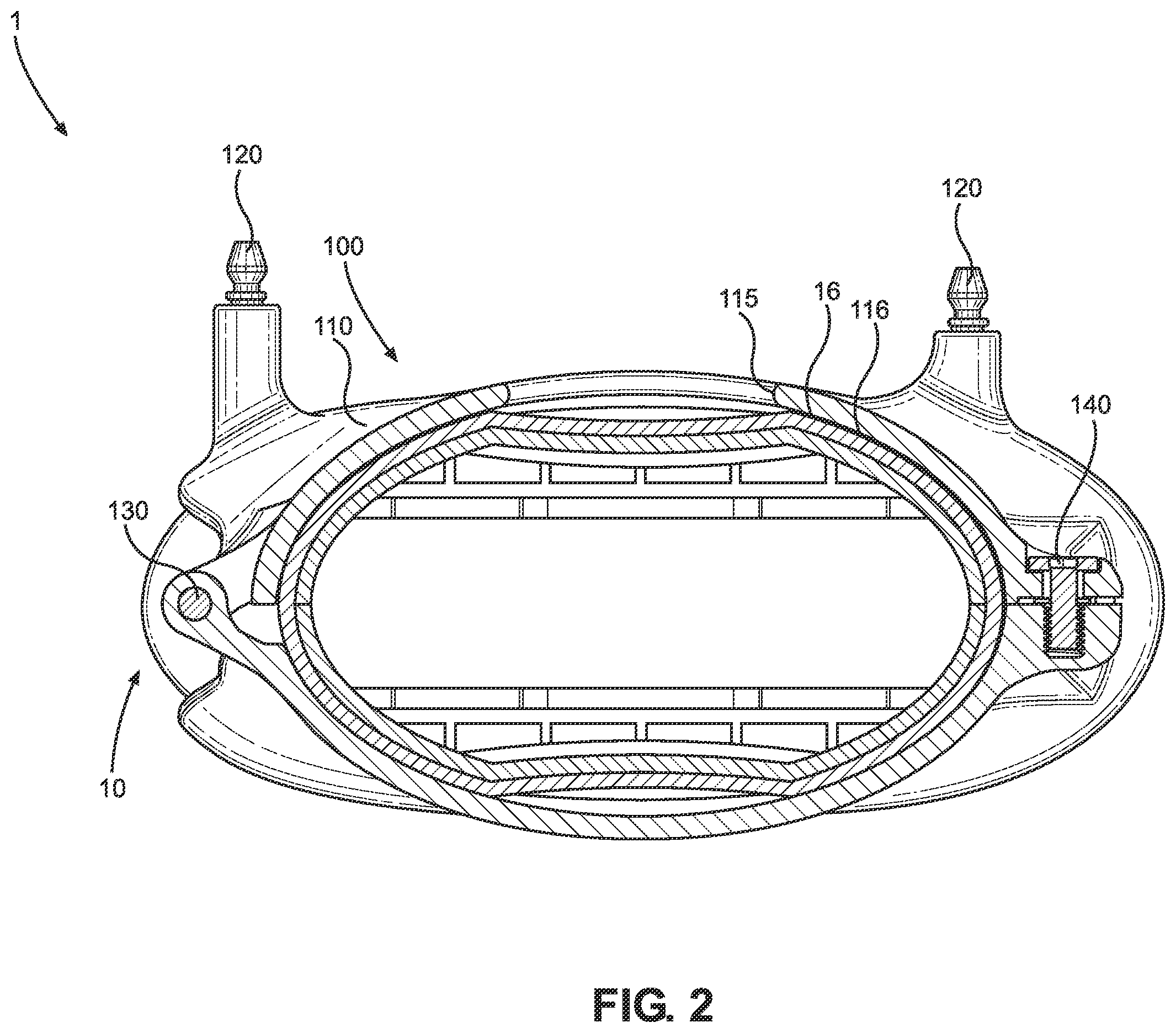 Patent US12396703 Figure 2 – Calibrationless reference marker system