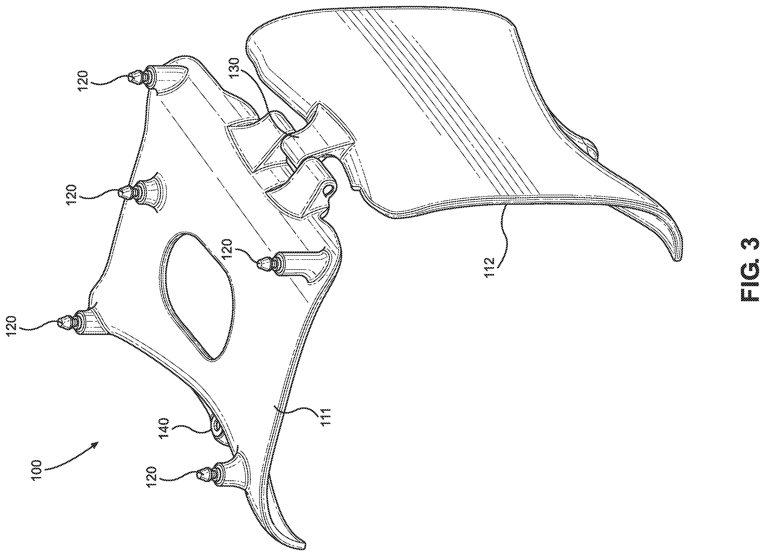 Patent US12396703 Figure 3 – Calibrationless reference marker system