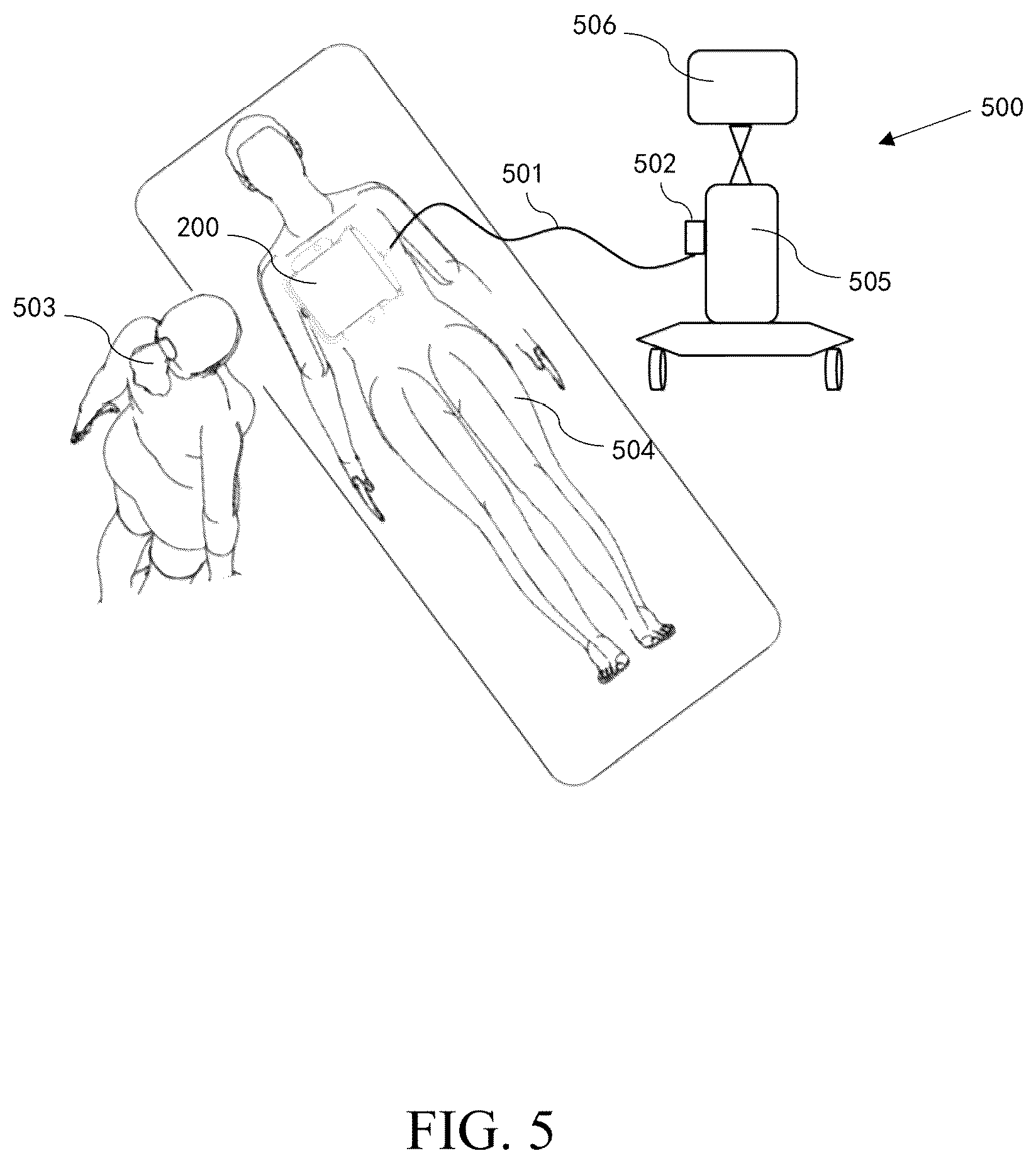 Patent US12396705 Figure 5 – Scanning assembly and ultrasound imaging device