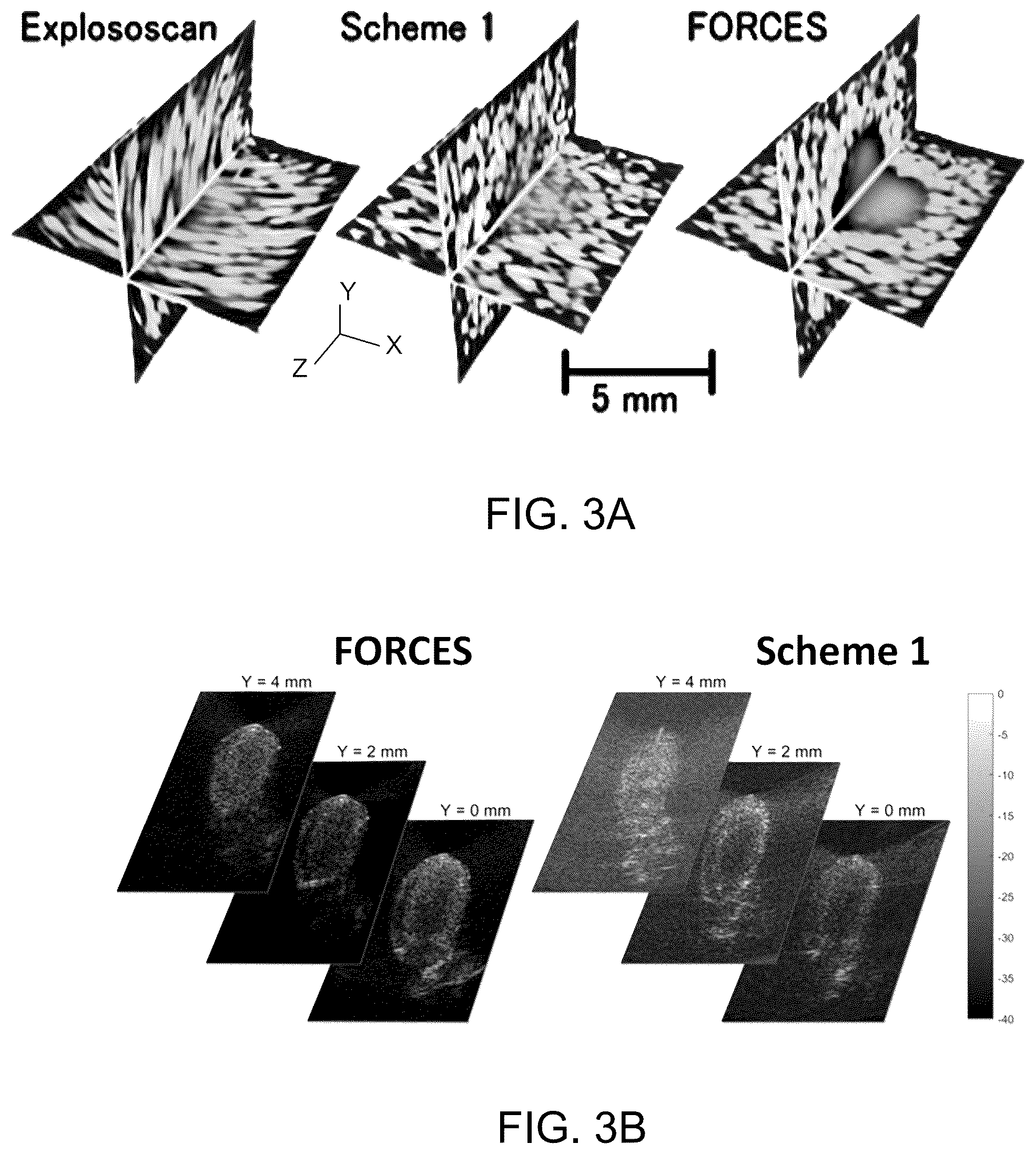 Patent US12396706 Figure 3 – Synthetic phase alternating row-column transducer array
