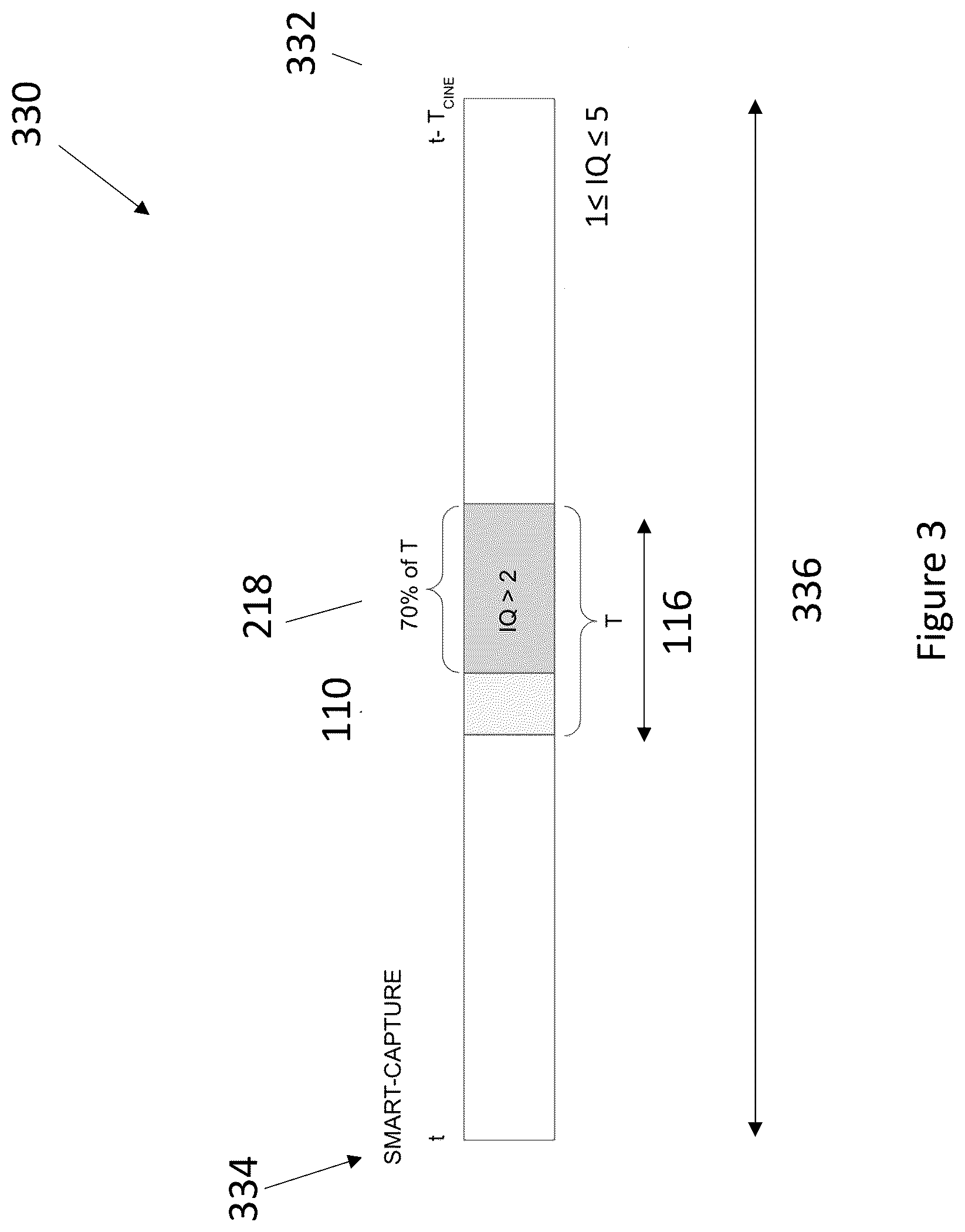 Patent US12396707 Figure 3 – Systems and methods for automated ultrasound image recording based on quality scores