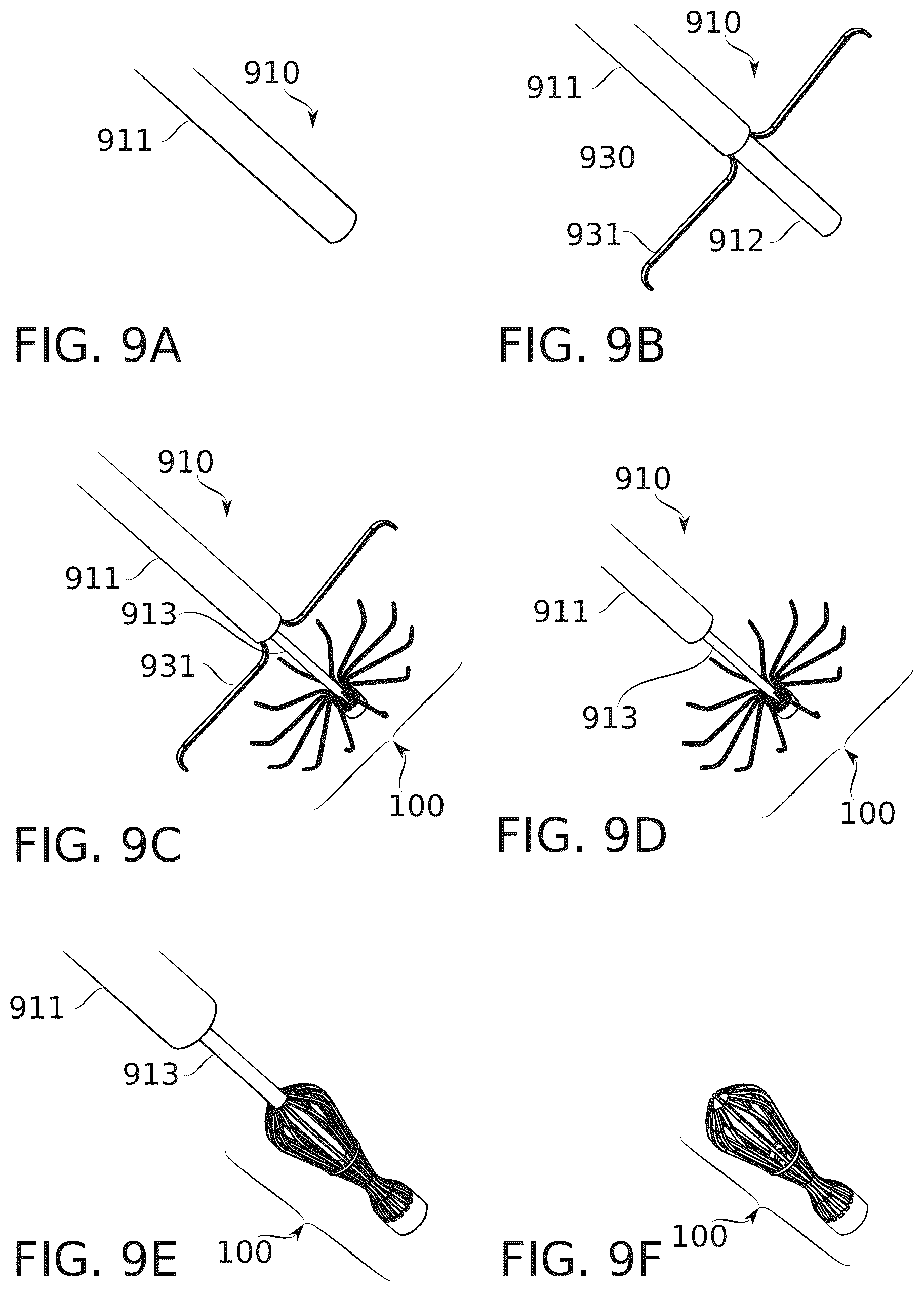 Patent US12396712 Figure 19 – Suturing clip