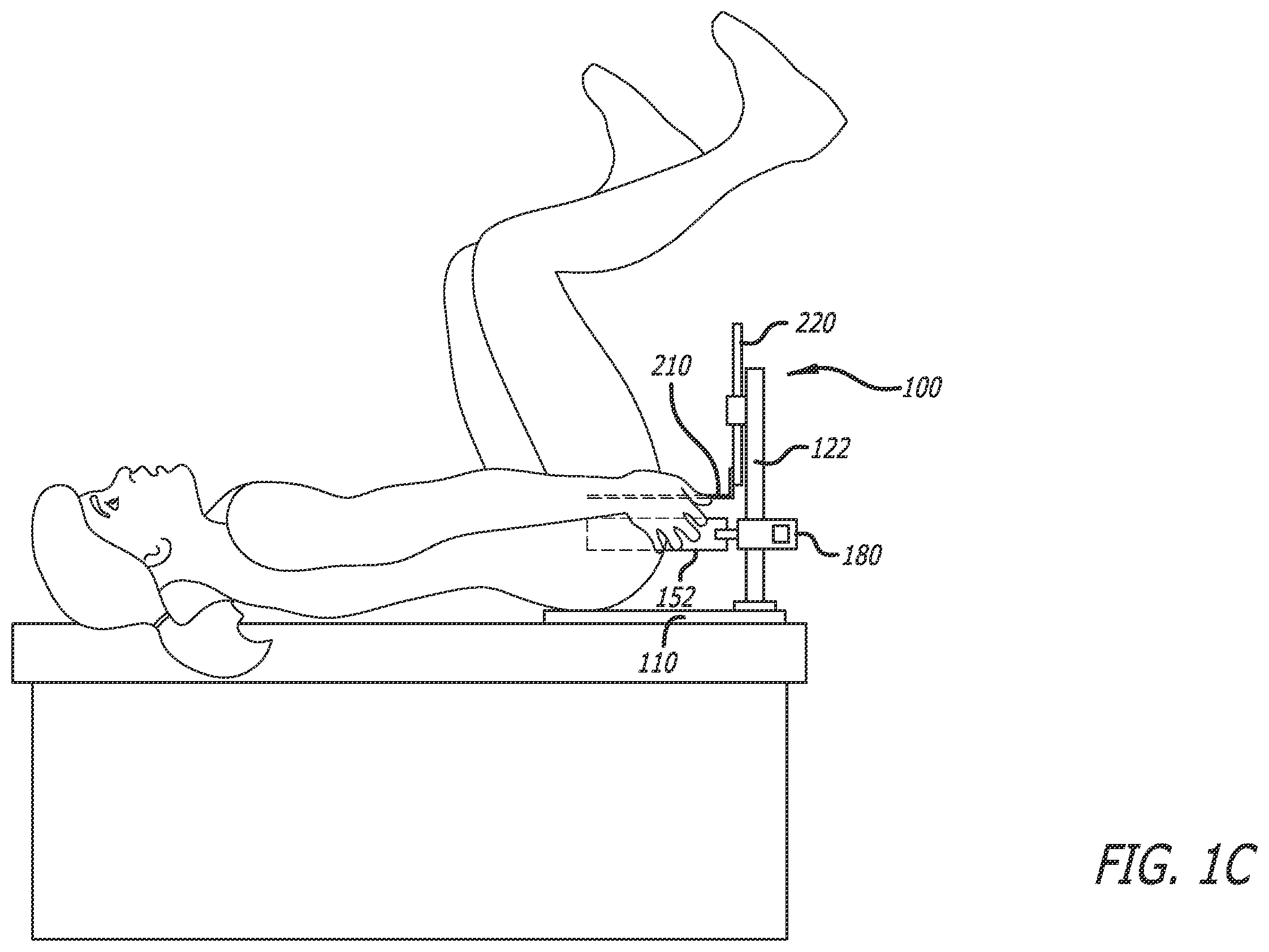 Patent US12396714 Figure 3 – Self-retaining surgical retractor