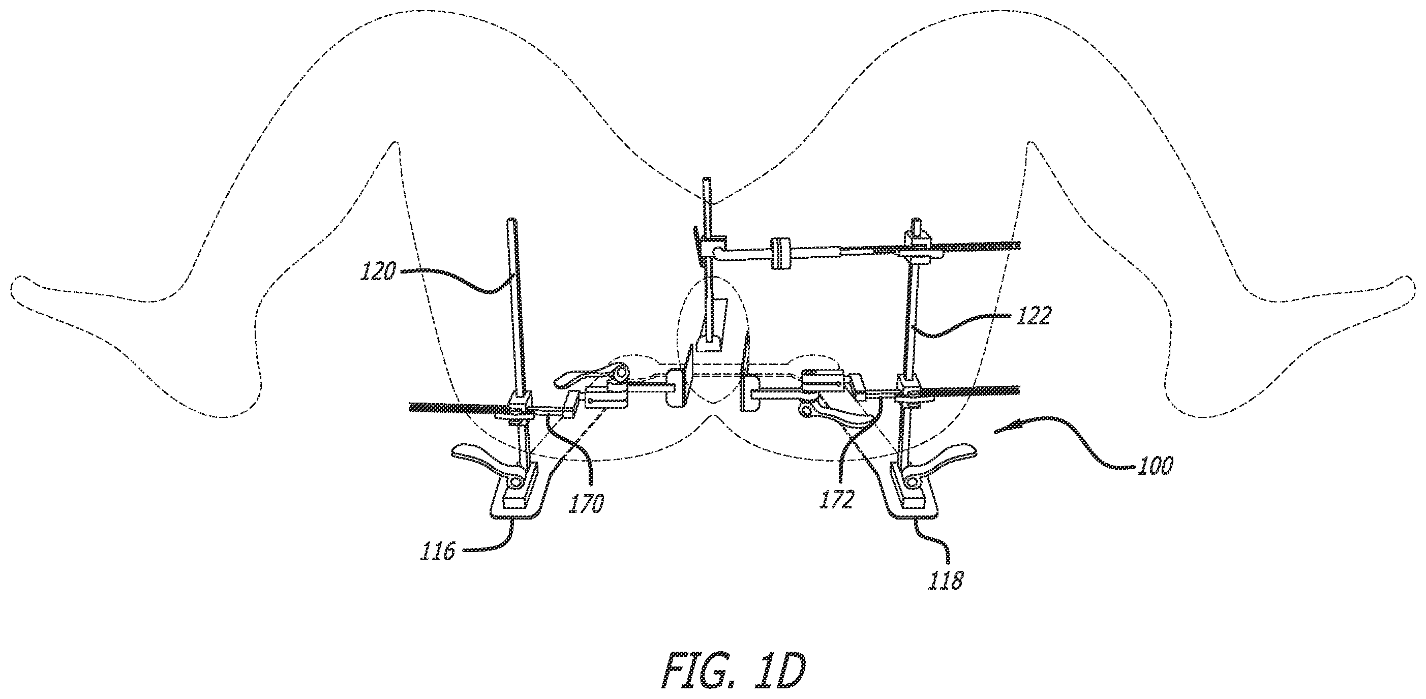 Patent US12396714 Figure 4 – Self-retaining surgical retractor