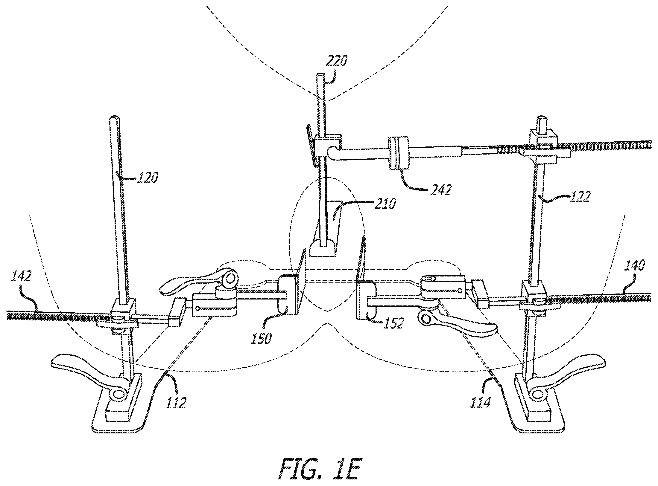 Patent US12396714 Figure 5 – Self-retaining surgical retractor