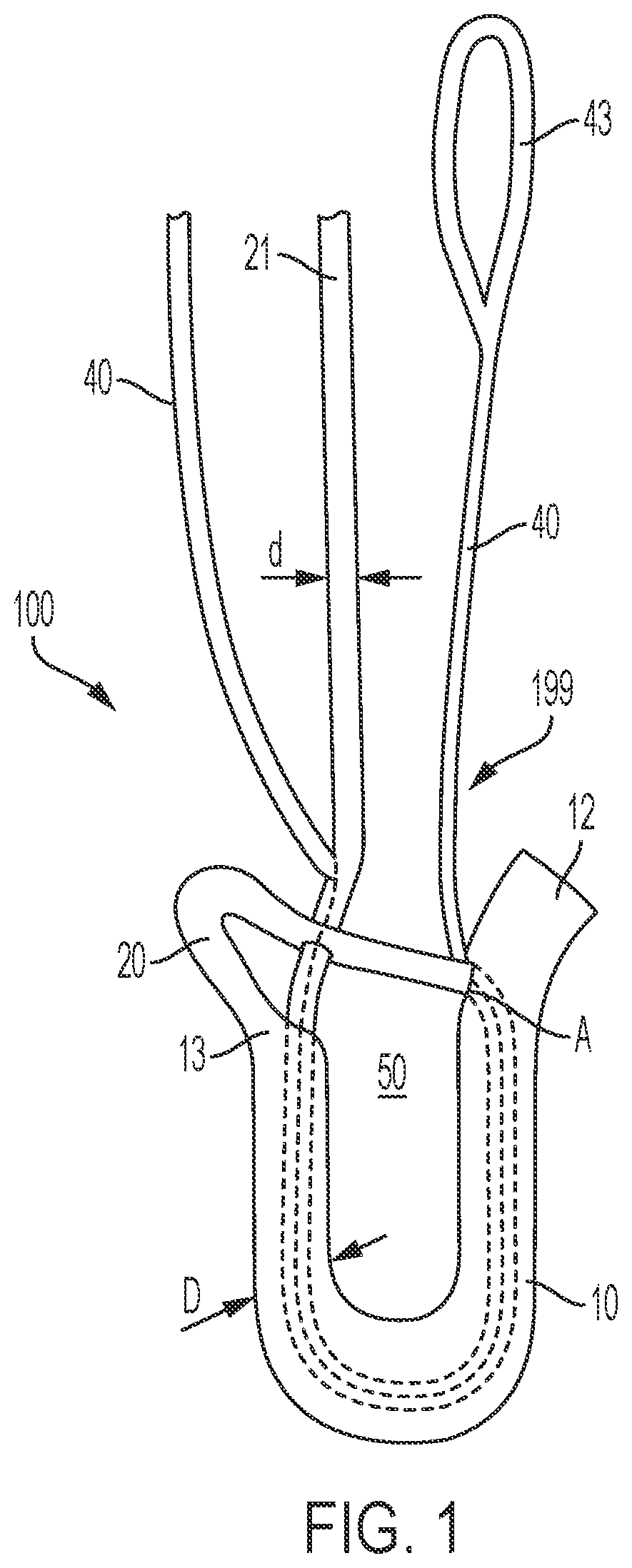 Patent US12396715 Figure 1 – Tensionable knotless anchors and methods of tissue repair