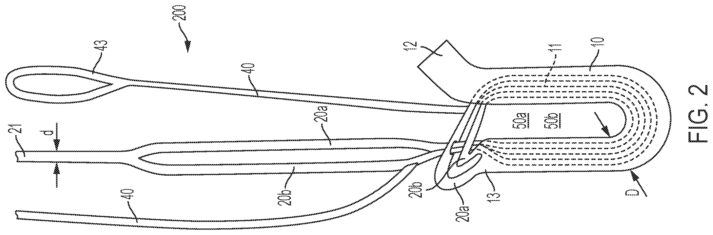 Patent US12396715 Figure 2 – Tensionable knotless anchors and methods of tissue repair