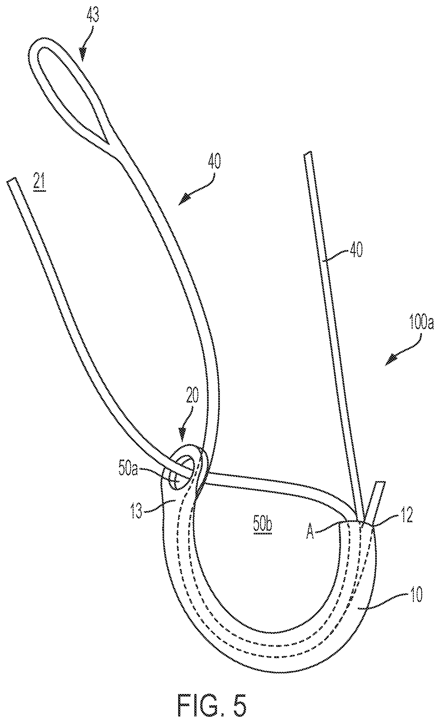 Patent US12396715 Figure 5 – Tensionable knotless anchors and methods of tissue repair