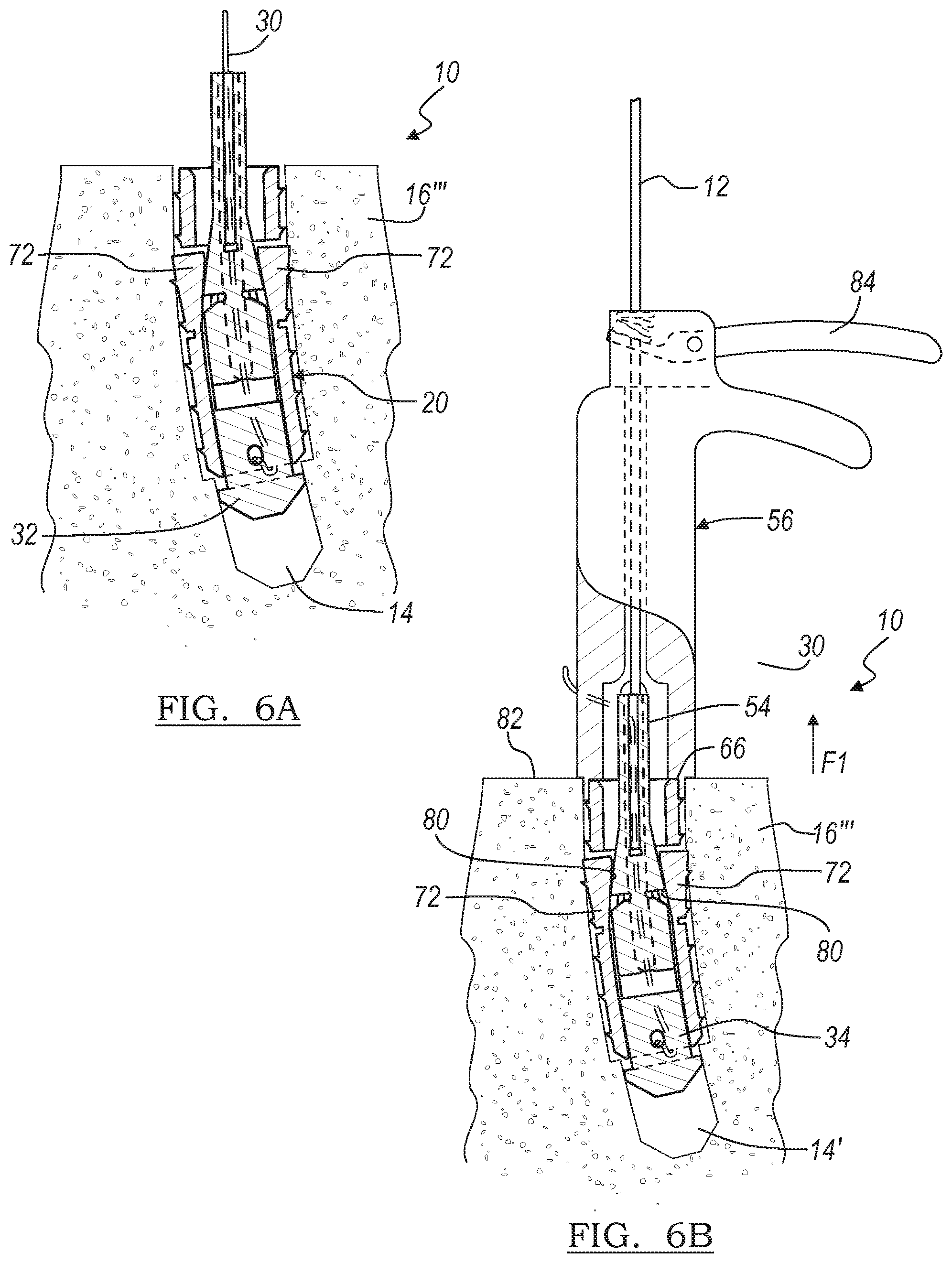 Patent US12396716 Figure 7 – Expanding suture anchor having an actuator pin