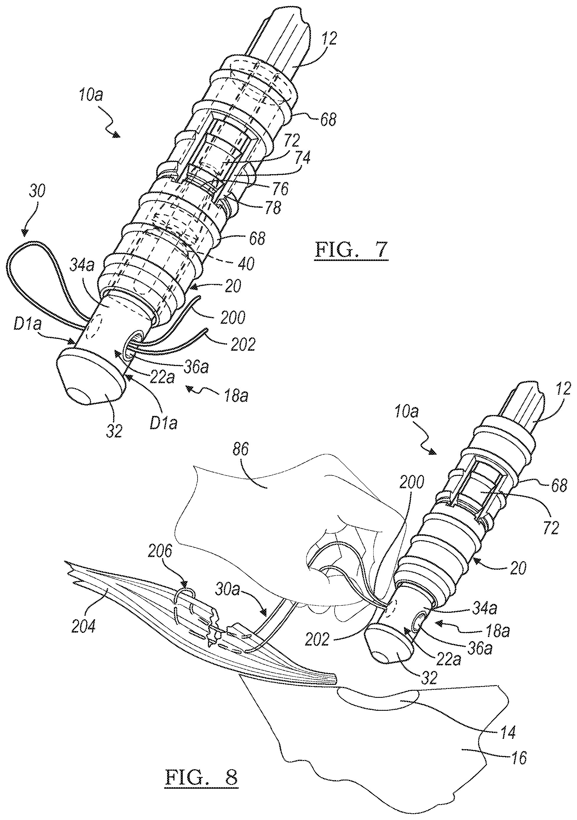 Patent US12396716 Figure 8 – Expanding suture anchor having an actuator pin