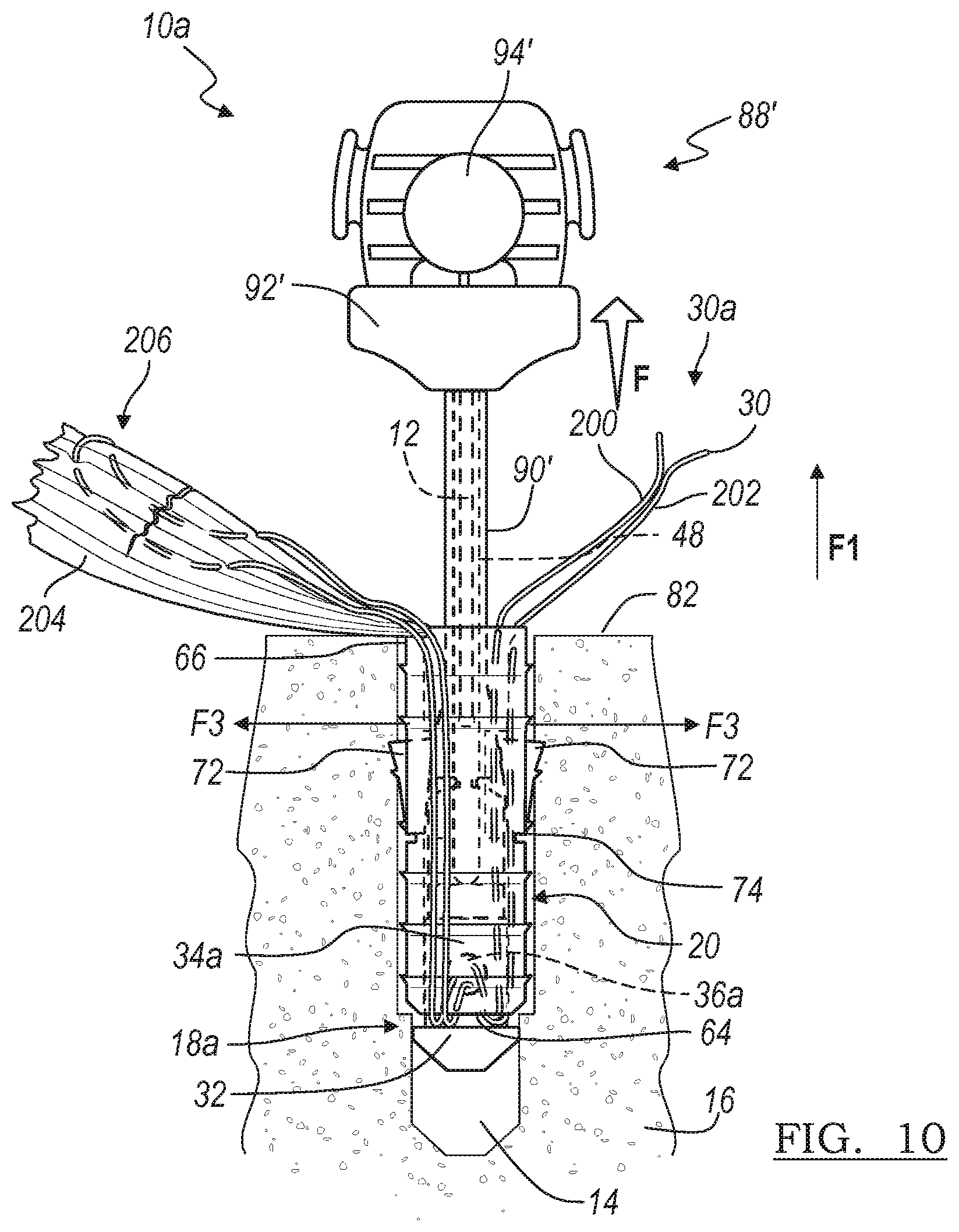 Patent US12396716 Figure 10 – Expanding suture anchor having an actuator pin