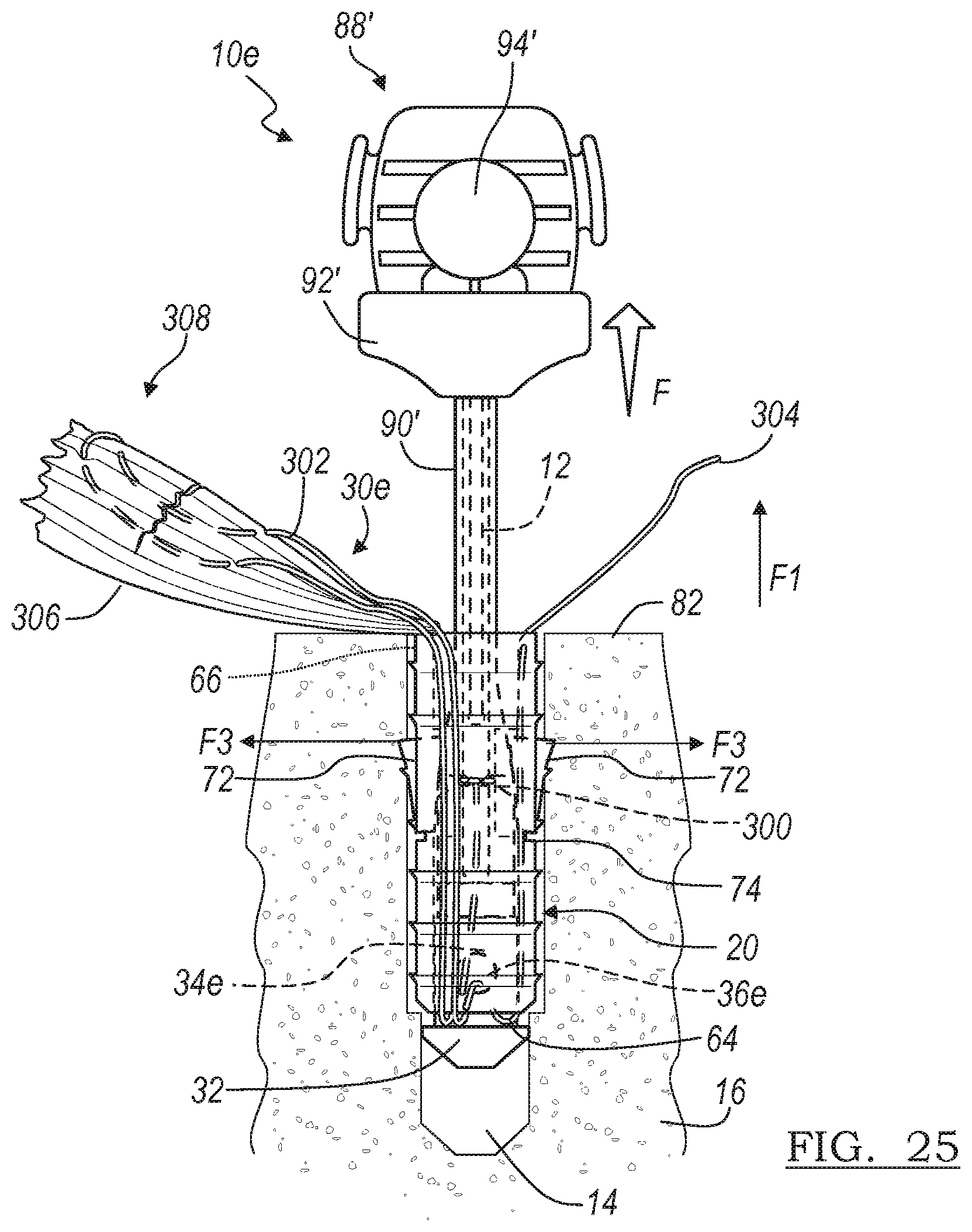 Patent US12396716 Figure 20 – Expanding suture anchor having an actuator pin