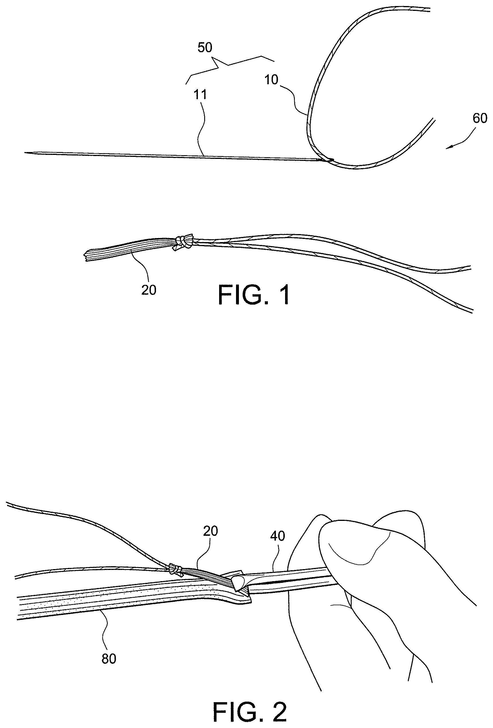 Patent US12396717 — Methods of making reinforced soft tissue grafts with suture loop/needle constructs — Figure 1