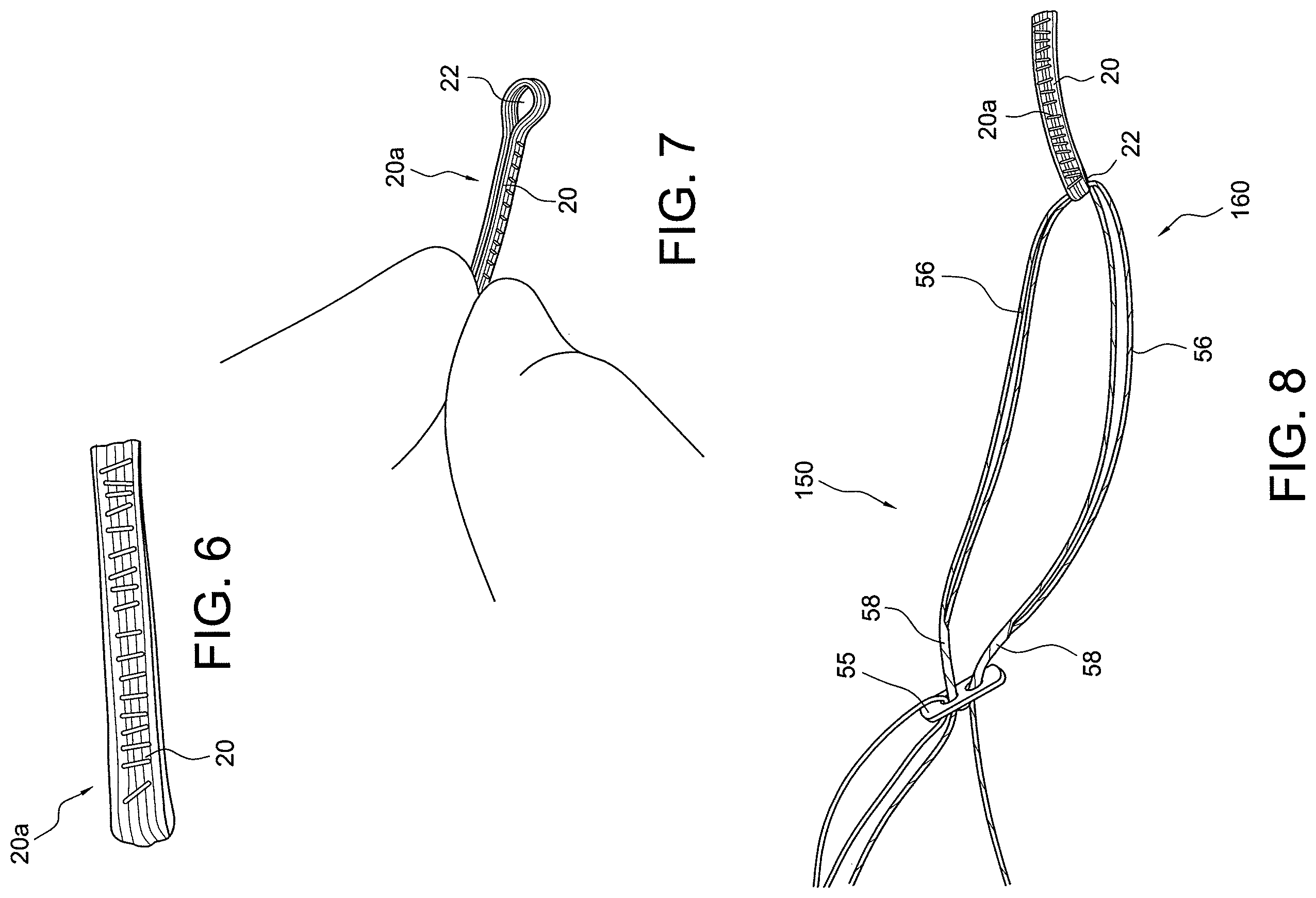Patent US12396717 Figure 5 – Methods of making reinforced soft tissue grafts with suture loop/needle constructs