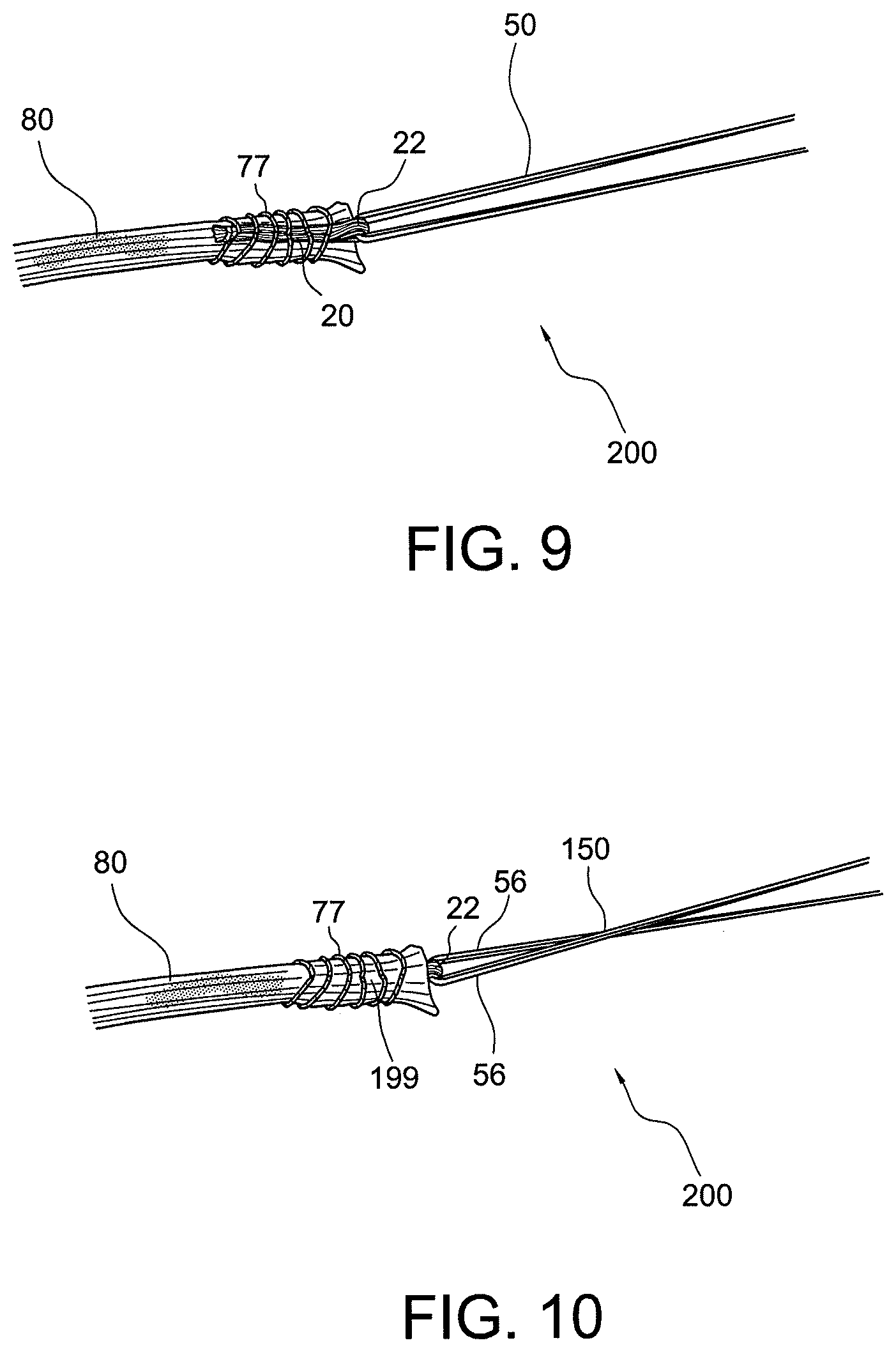 Patent US12396717 Figure 6 – Methods of making reinforced soft tissue grafts with suture loop/needle constructs