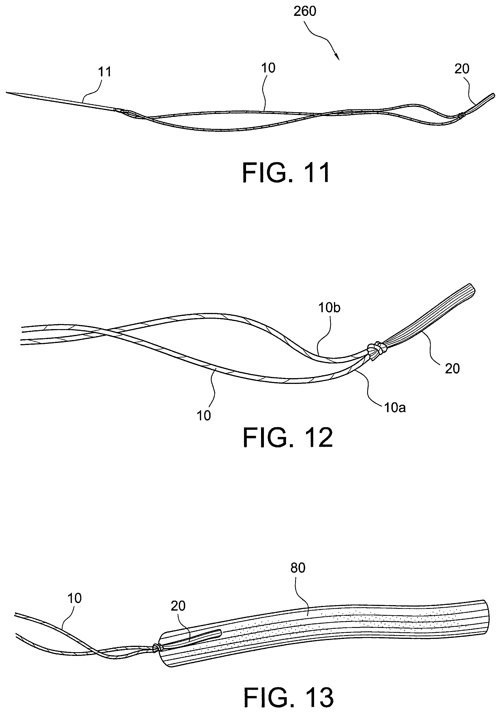 Patent US12396717 Figure 7 – Methods of making reinforced soft tissue grafts with suture loop/needle constructs