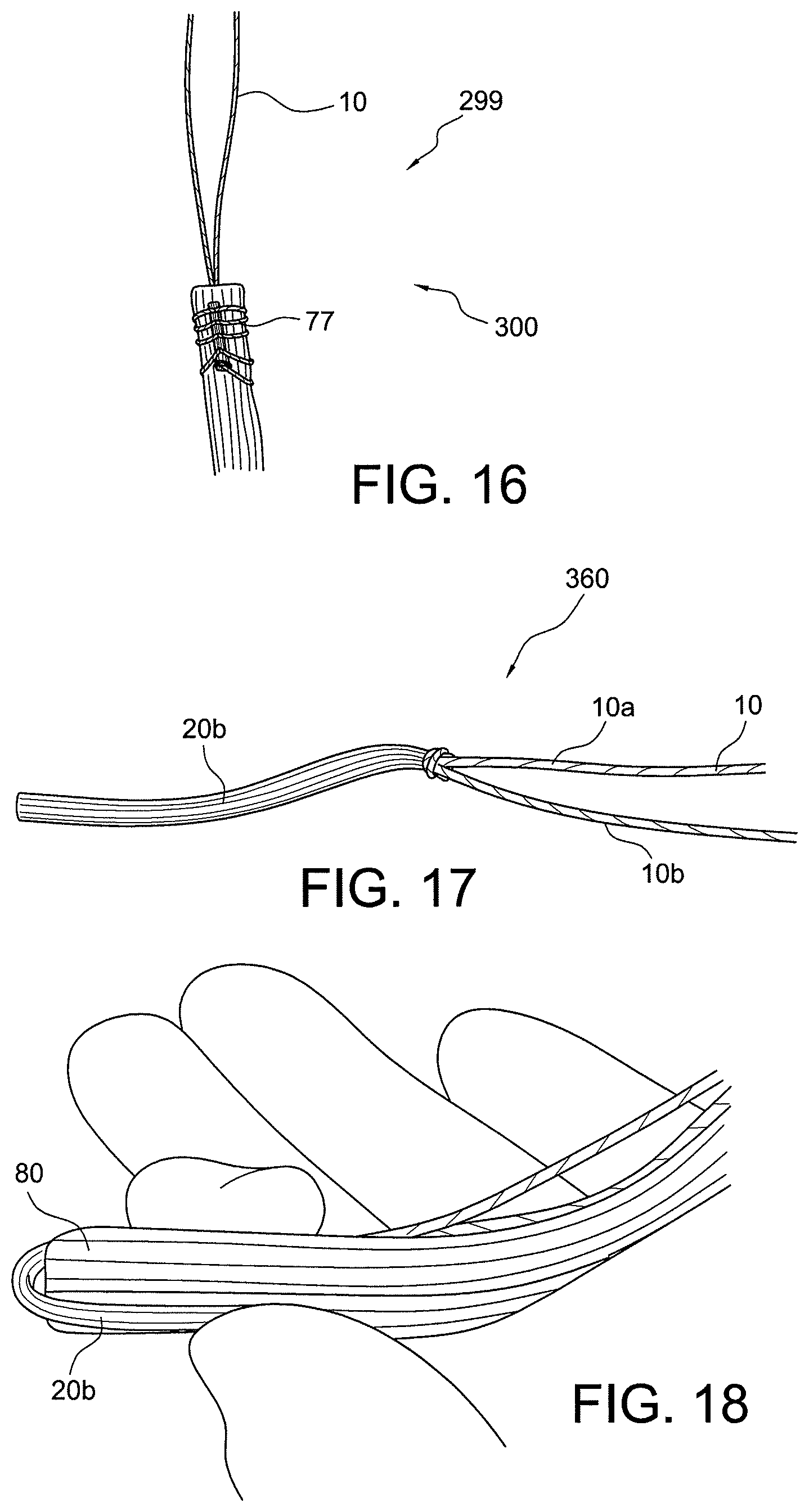 Patent US12396717 Figure 9 – Methods of making reinforced soft tissue grafts with suture loop/needle constructs