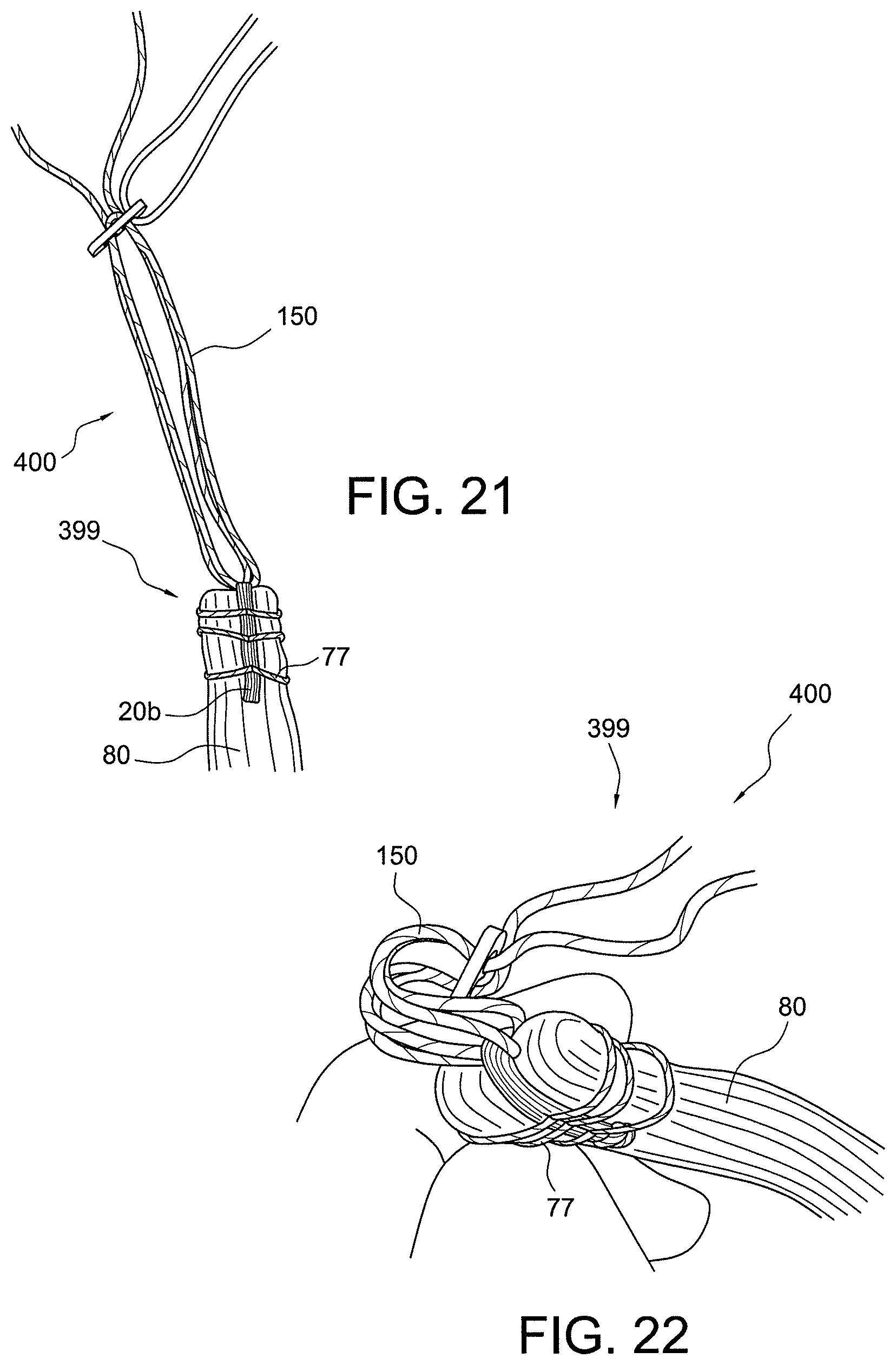 Patent US12396717 Figure 11 – Methods of making reinforced soft tissue grafts with suture loop/needle constructs