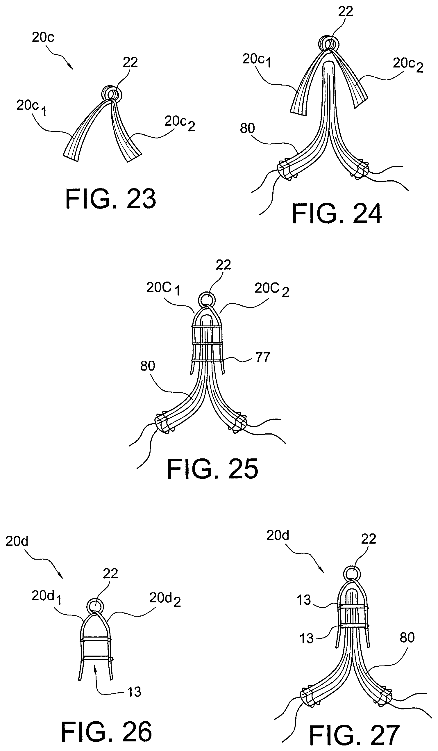 Patent US12396717 Figure 12 – Methods of making reinforced soft tissue grafts with suture loop/needle constructs