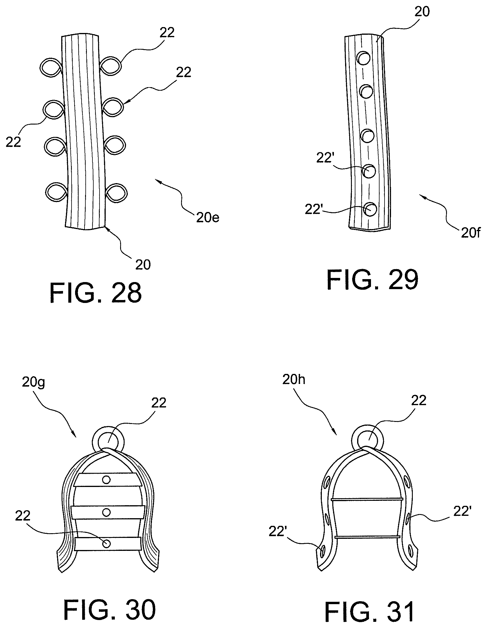 Patent US12396717 Figure 13 – Methods of making reinforced soft tissue grafts with suture loop/needle constructs