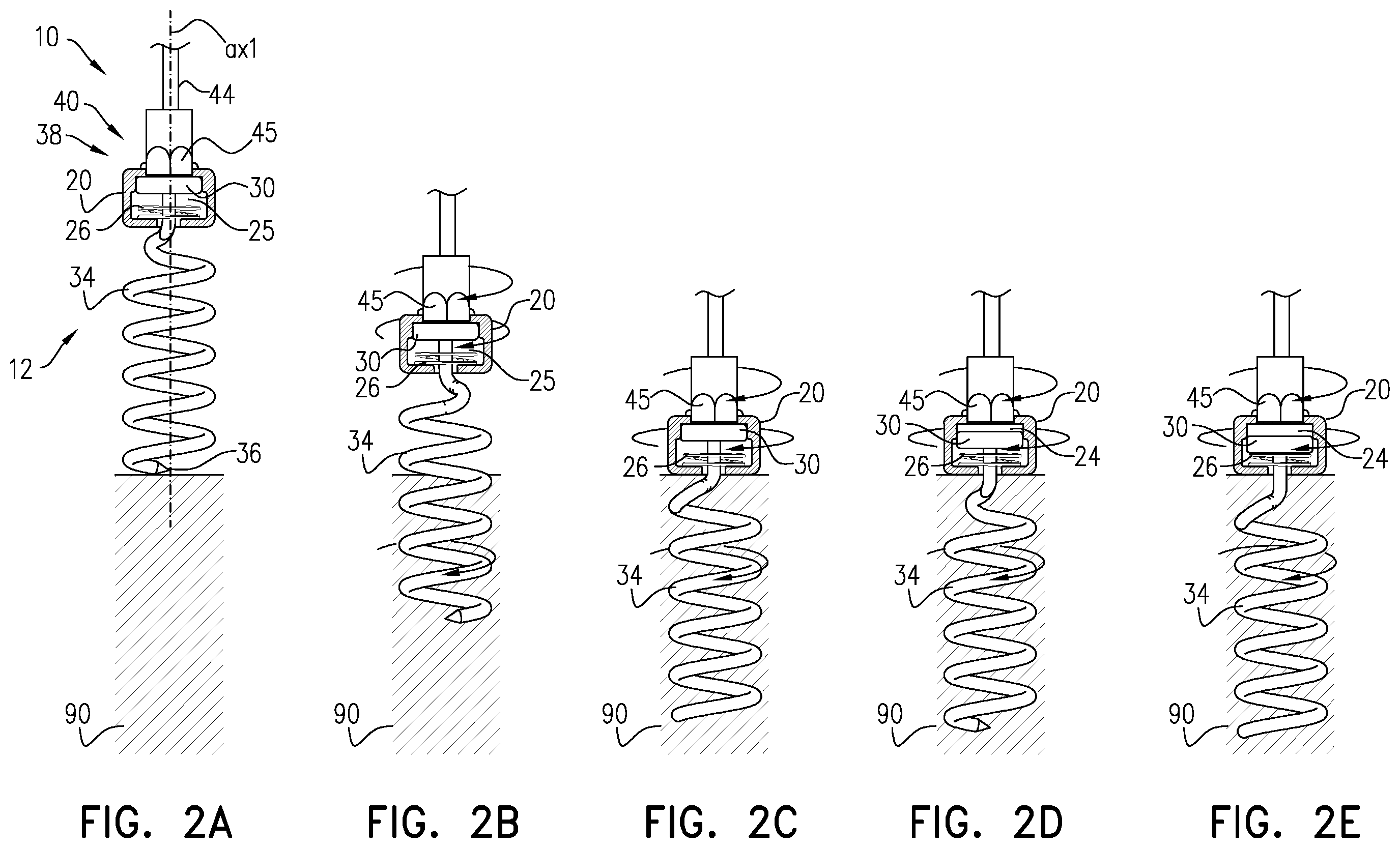 Patent US12396718 Figure 3 – Self-stopping tissue anchors