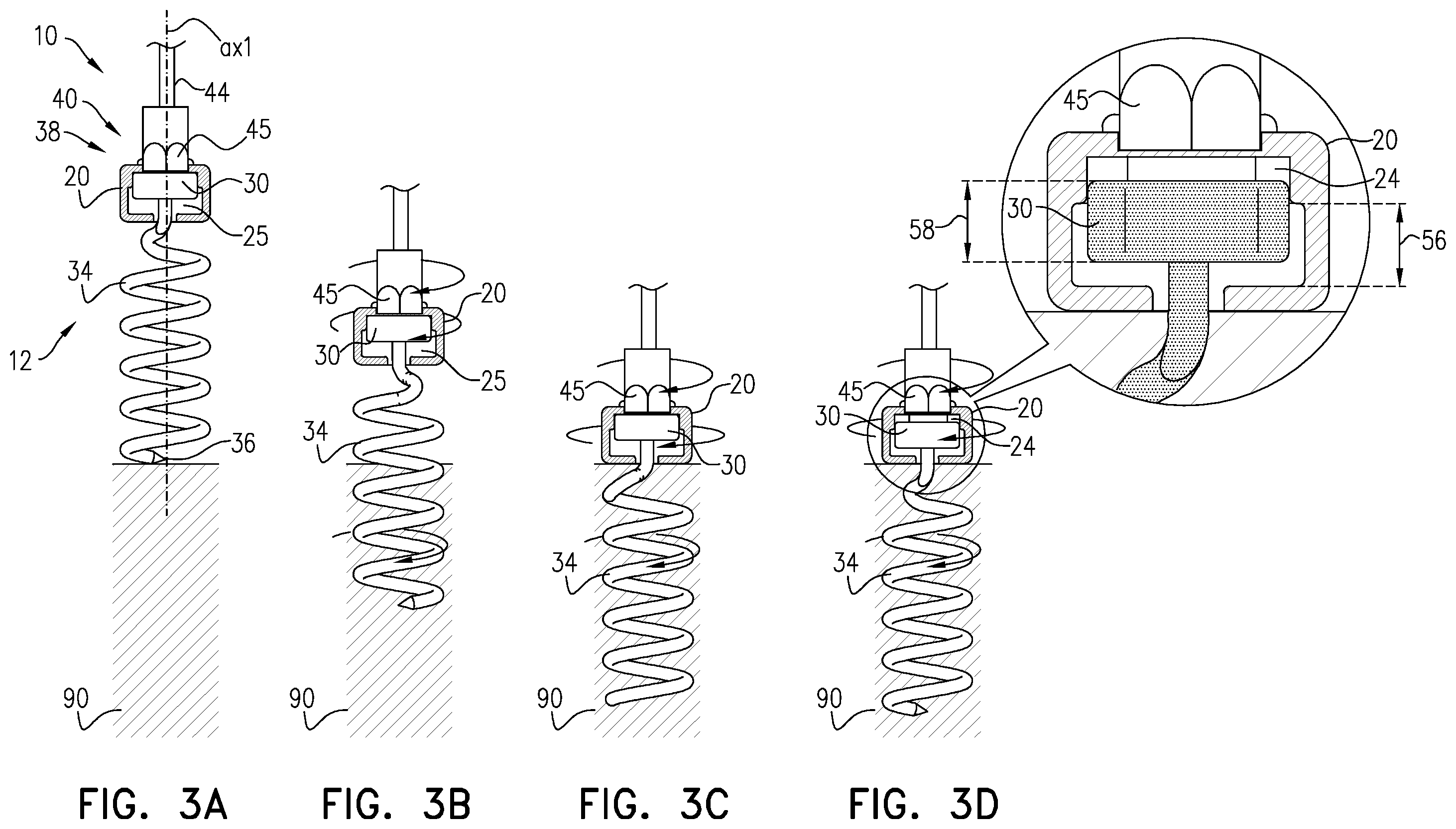Patent US12396718 Figure 5 – Self-stopping tissue anchors
