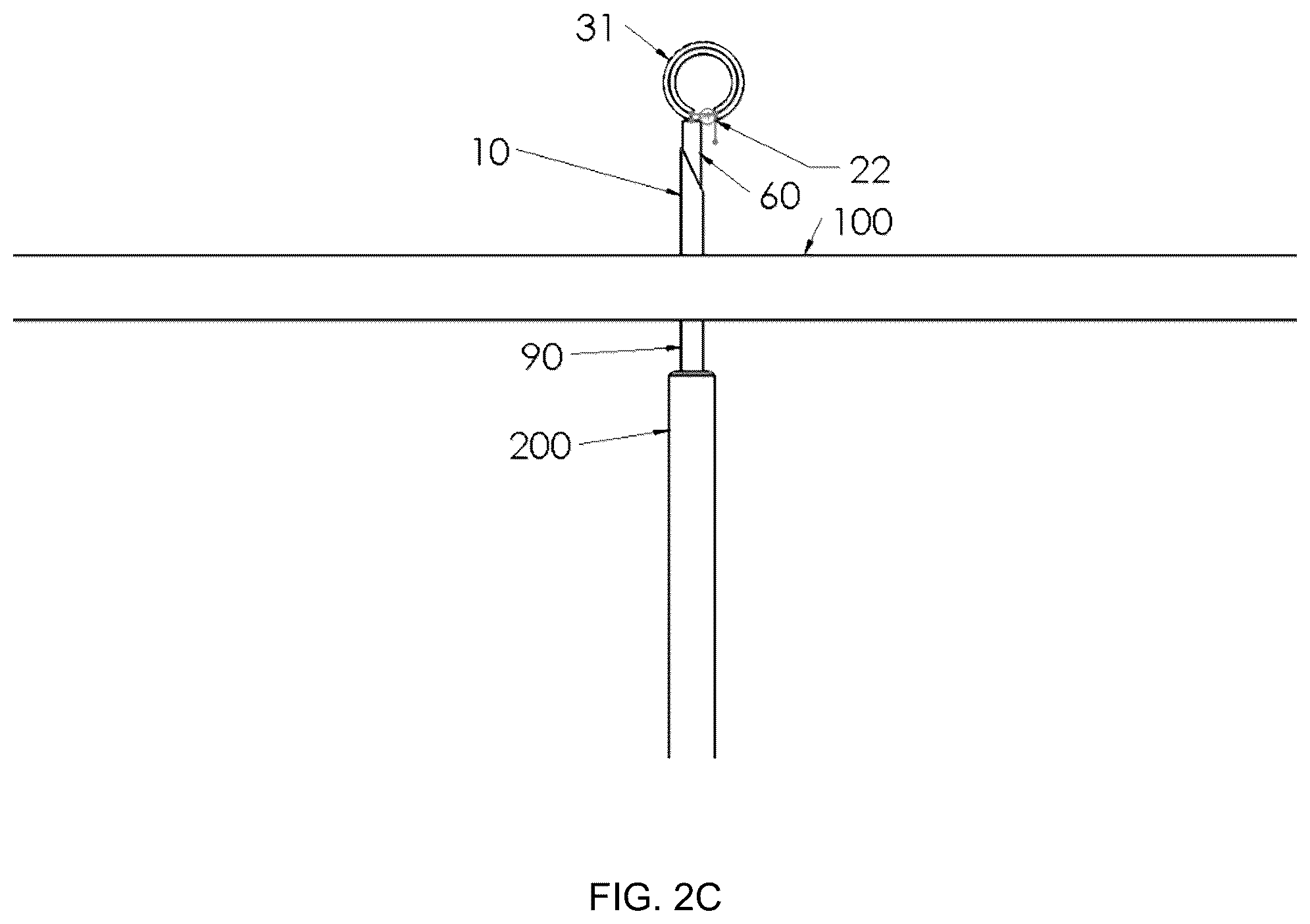 Patent US12396719 Figure 4 – Soft tissue fixation system
