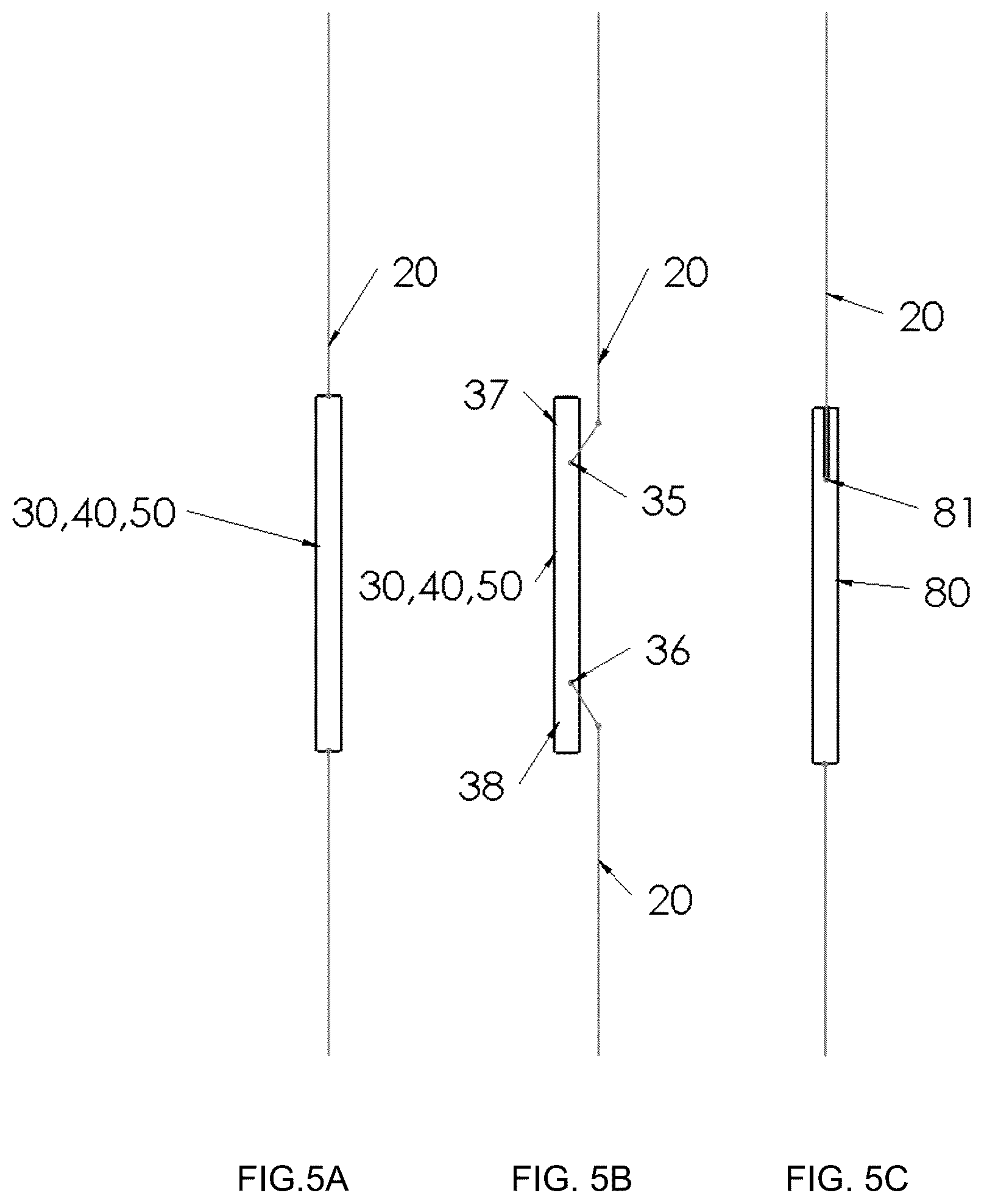 Patent US12396719 Figure 12 – Soft tissue fixation system