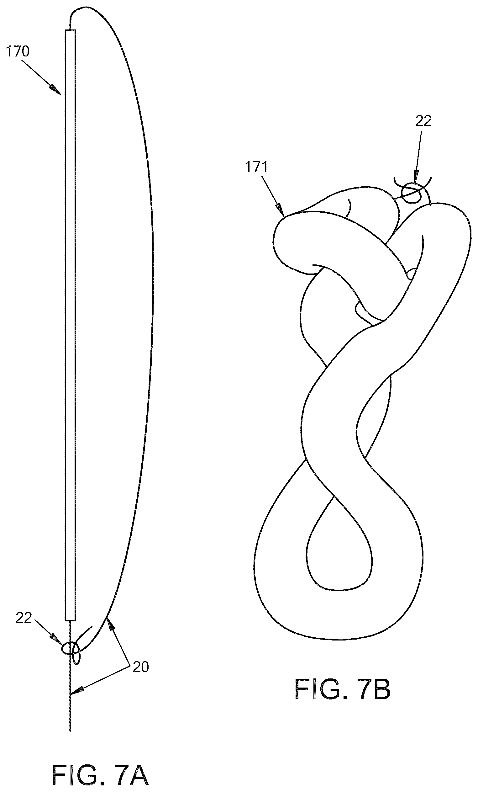 Patent US12396719 Figure 14 – Soft tissue fixation system